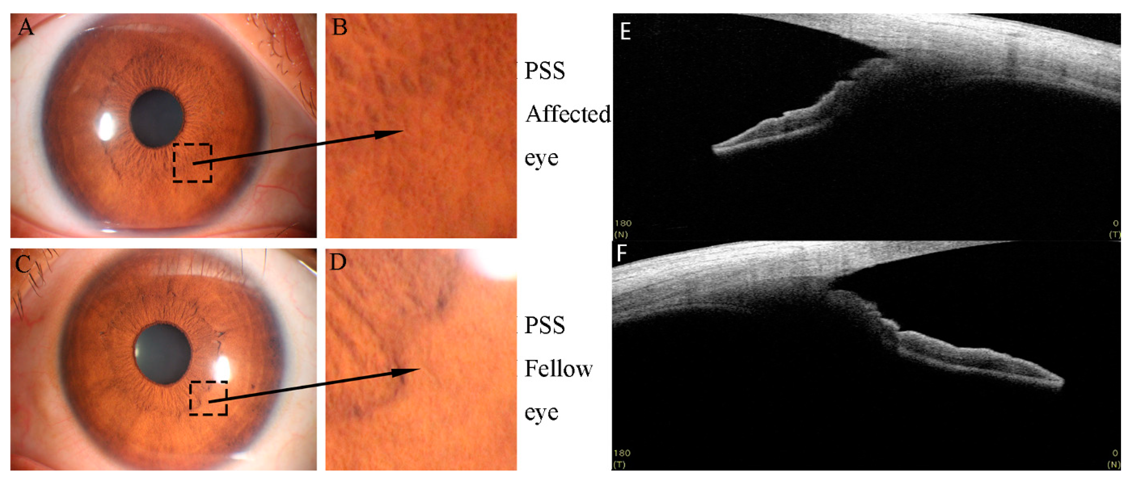 Jcm 11 06484 g002 Jcm 11 06484 g002