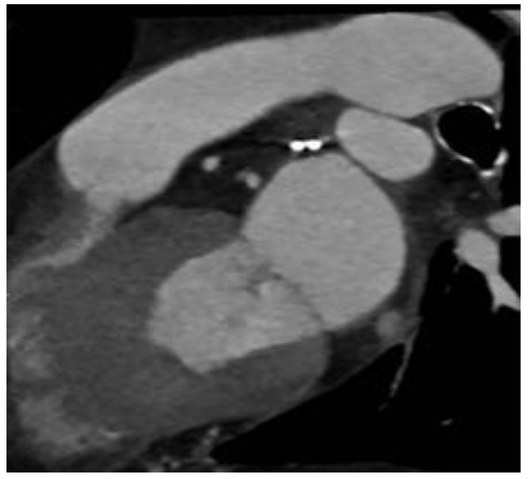 Jcm 11 06492 g001 Jcm 11 06492 g001