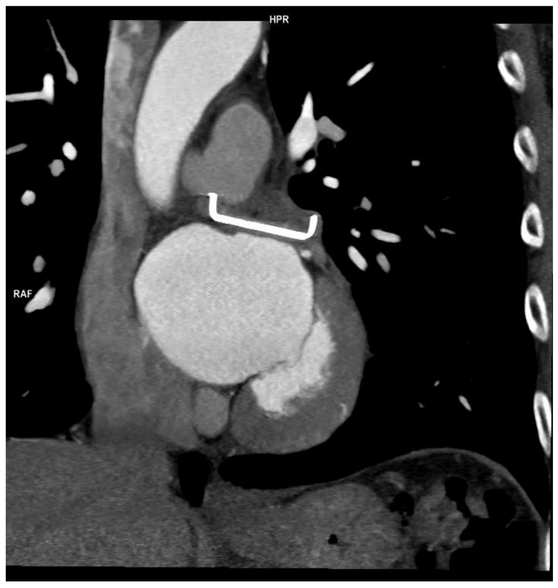 Jcm 11 06492 g002 Jcm 11 06492 g002