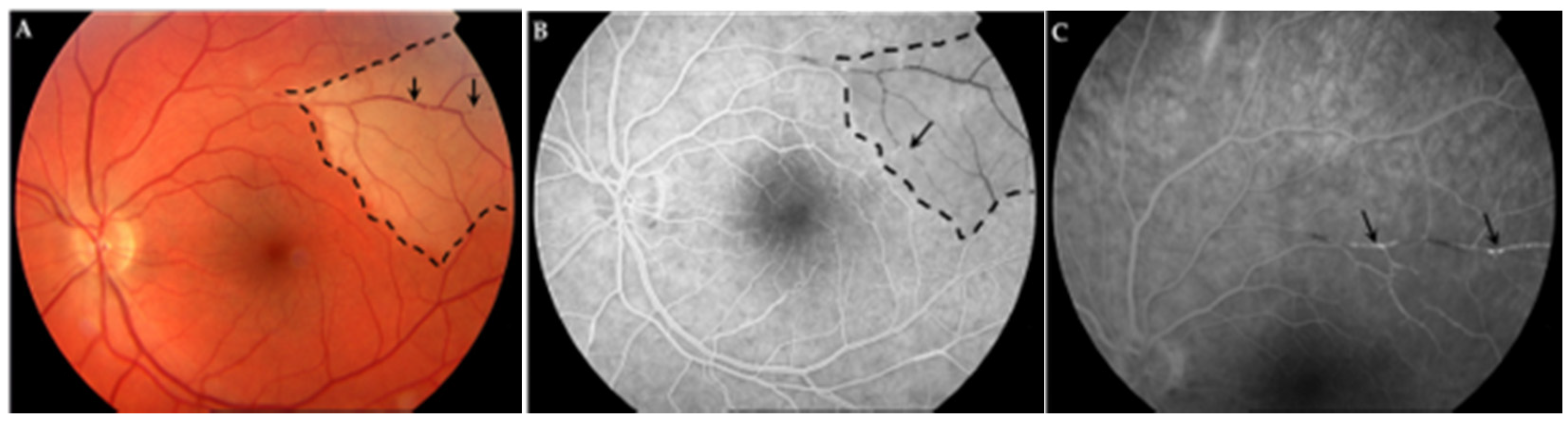 Jcm 11 06549 g002 Jcm 11 06549 g002