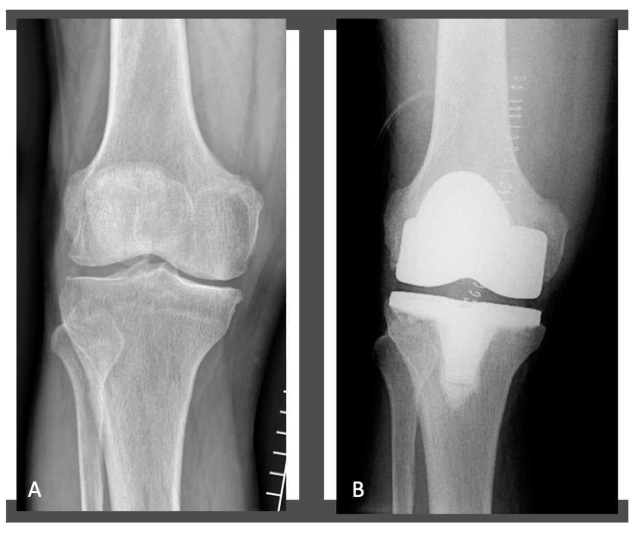 JCM Free FullText No Significant Differences in Clinical and