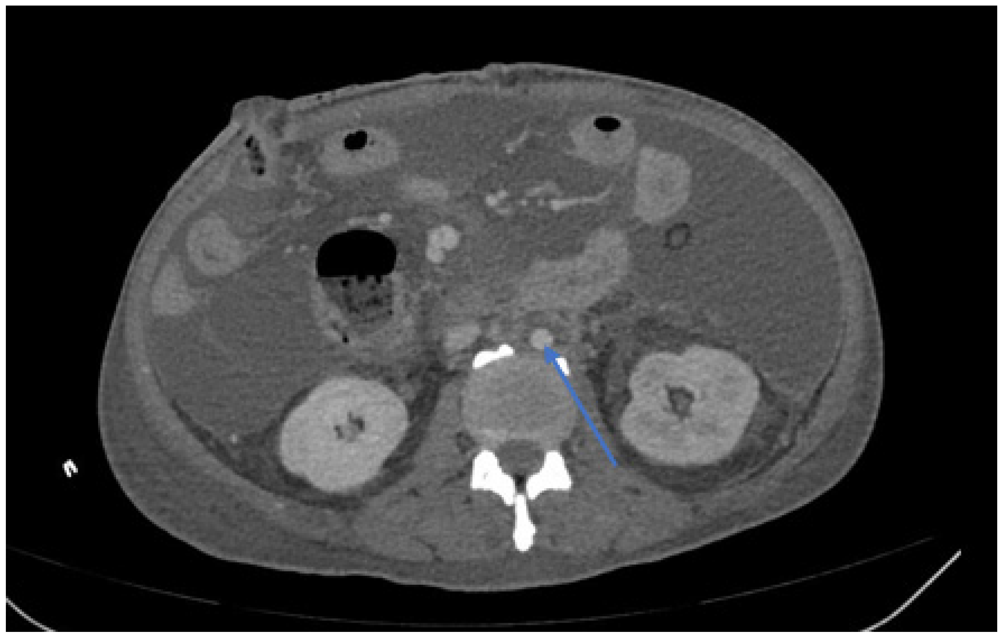 Jcm 11 06588 g003 Jcm 11 06588 g003