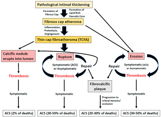 Frontiers  Characteristics and evaluation of atherosclerotic plaques: an  overview of state-of-the-art techniques