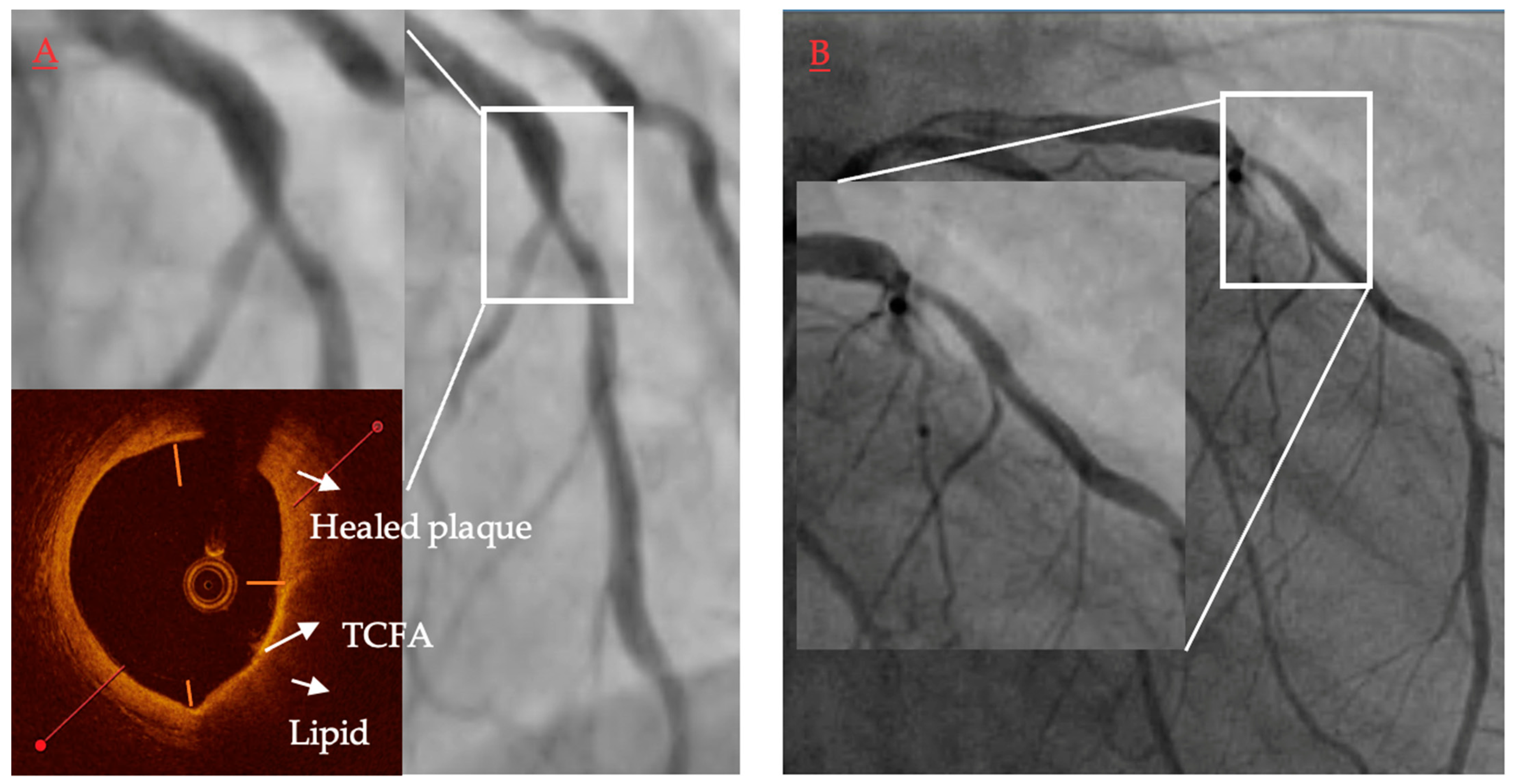 Jcm 11 06639 g005 Jcm 11 06639 g005