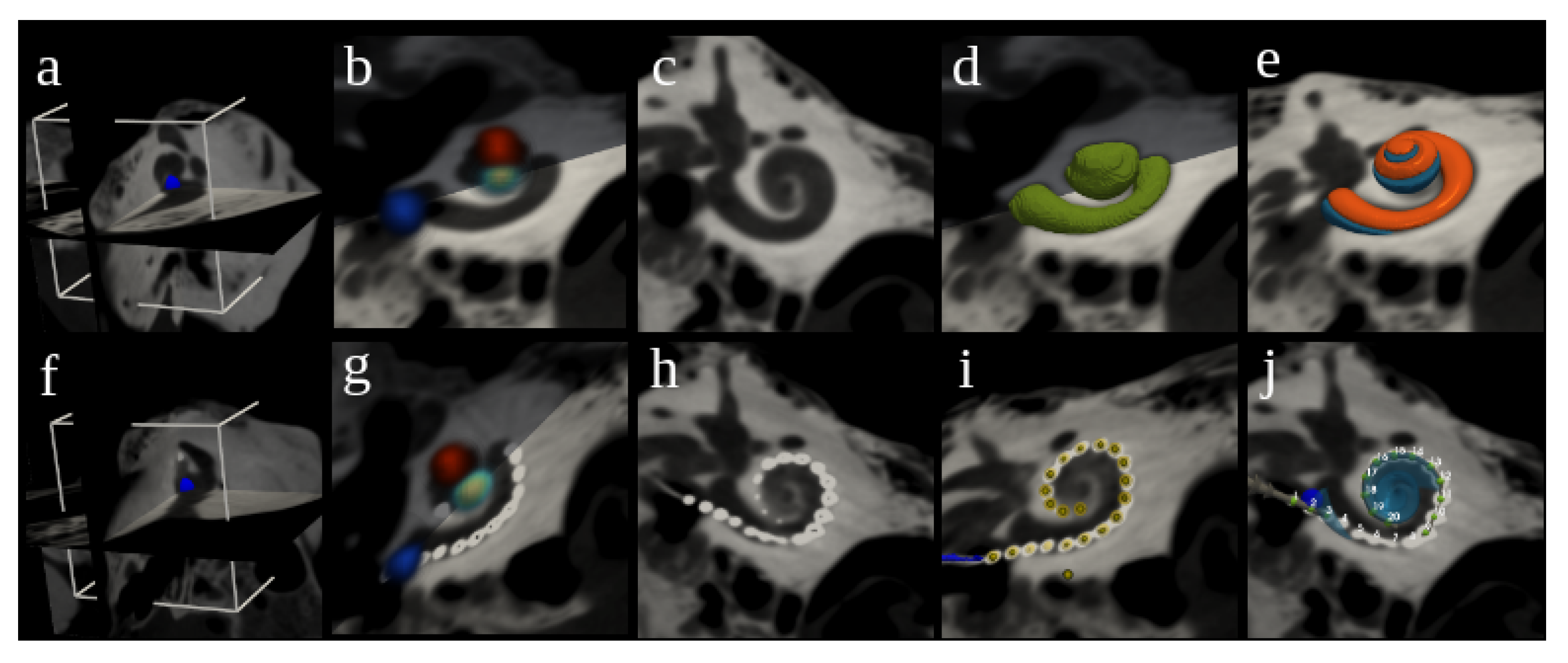 Jcm 11 06640 g003 Jcm 11 06640 g003