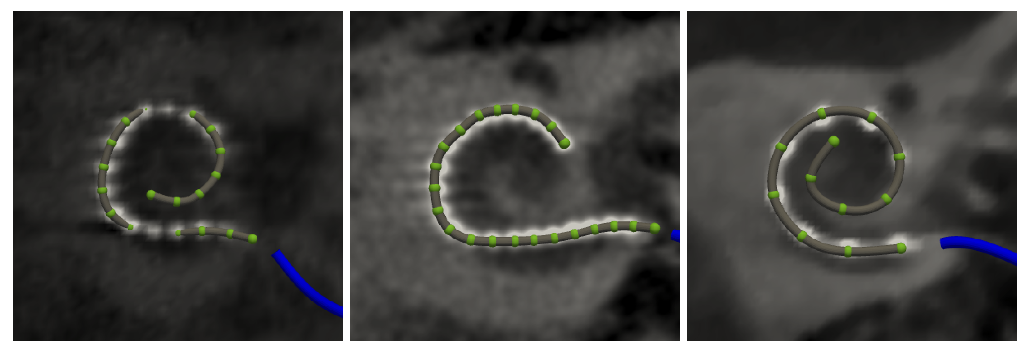 Jcm 11 06640 g005 Jcm 11 06640 g005