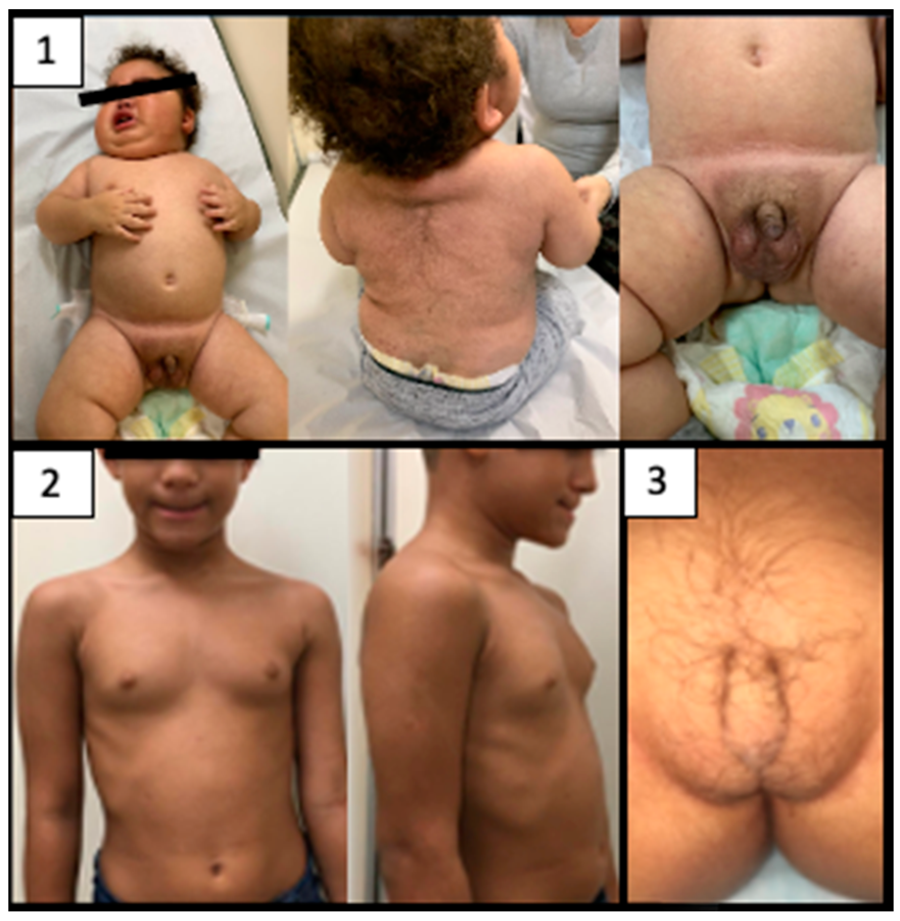 Jcm 11 06641 g002 Jcm 11 06641 g002