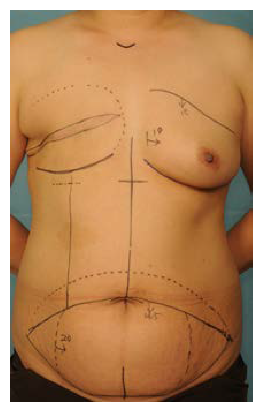 Jcm 11 06647 g001 Jcm 11 06647 g001