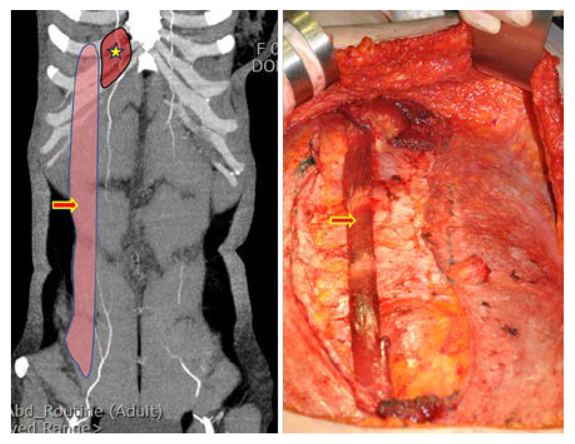 Jcm 11 06647 g002 Jcm 11 06647 g002