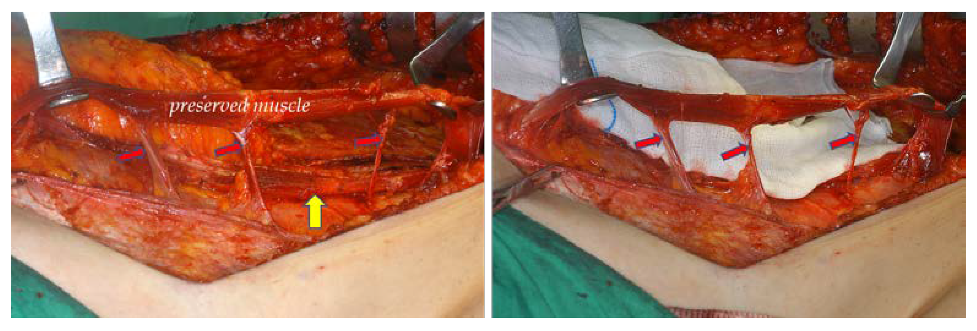 Jcm 11 06647 g003 Jcm 11 06647 g003