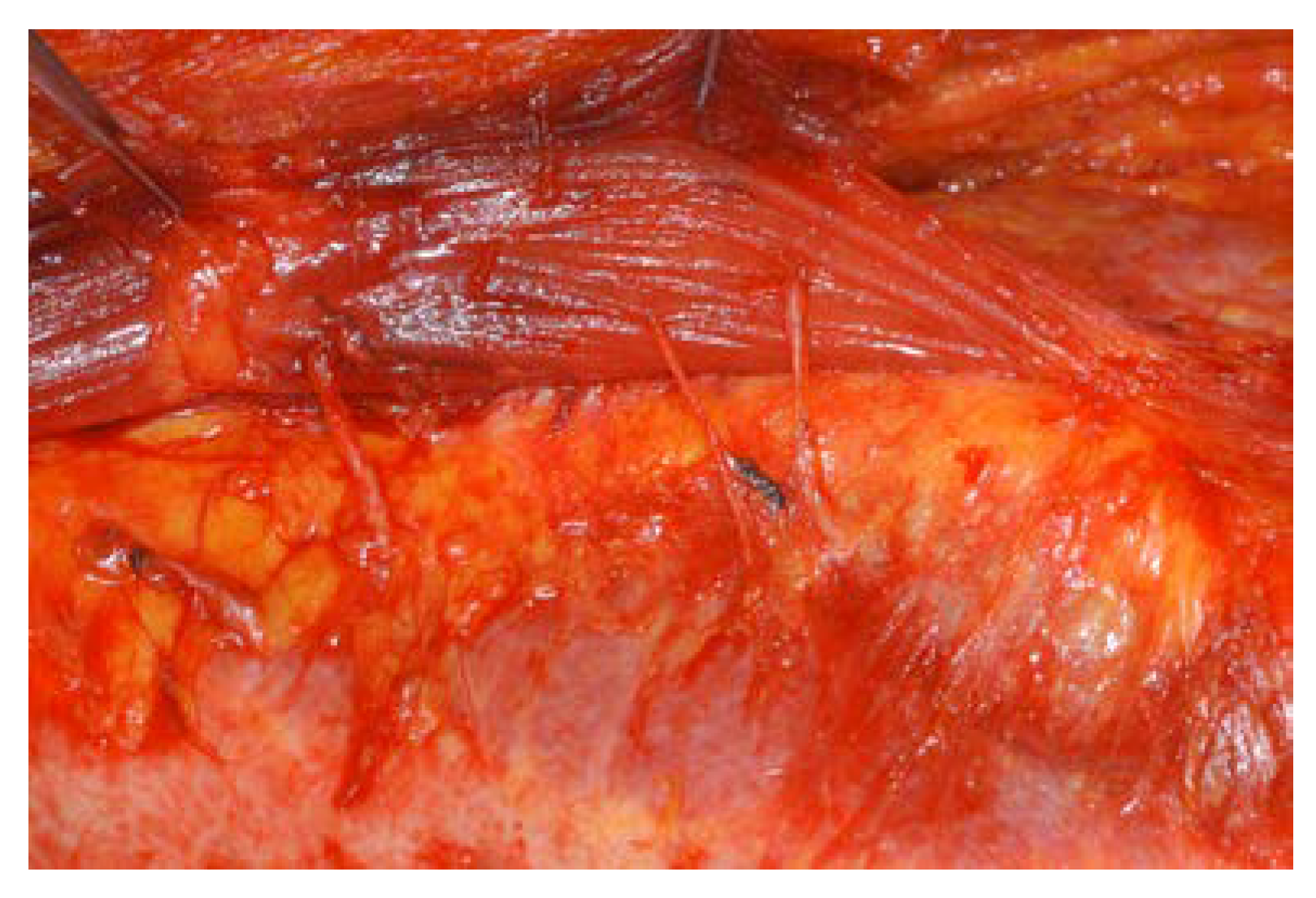 Jcm 11 06647 g004 Jcm 11 06647 g004