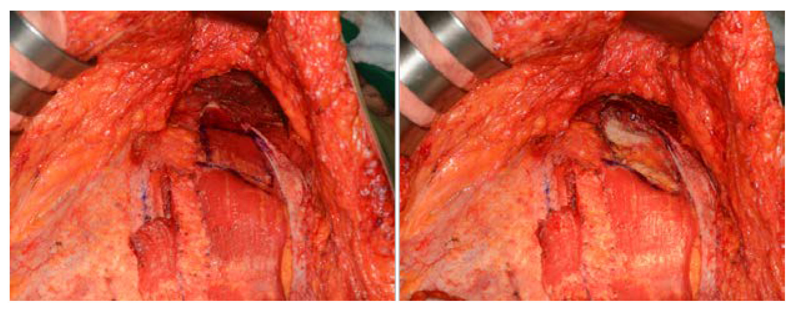 Jcm 11 06647 g005 Jcm 11 06647 g005