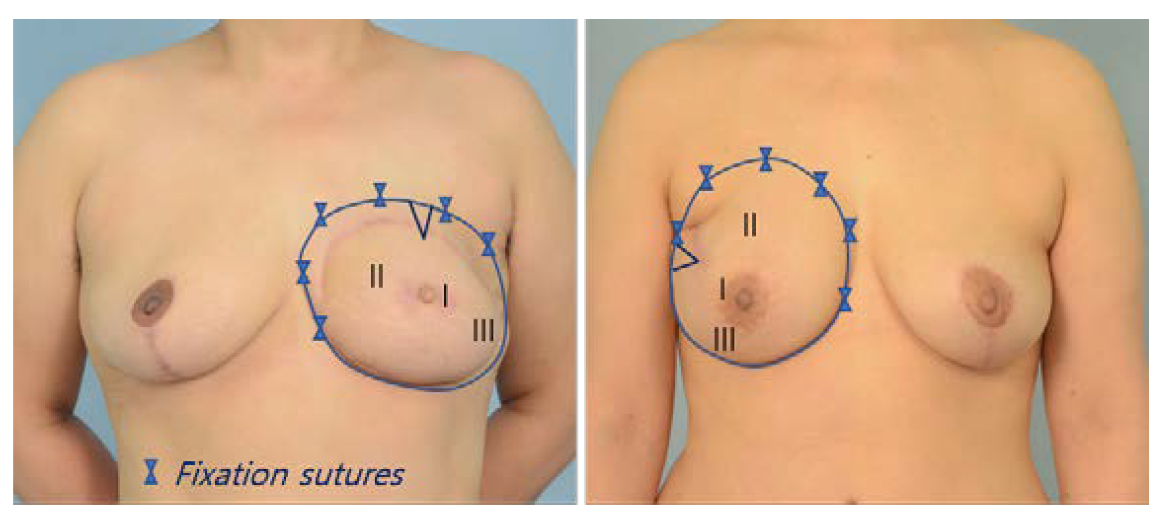 Jcm 11 06647 g007 Jcm 11 06647 g007