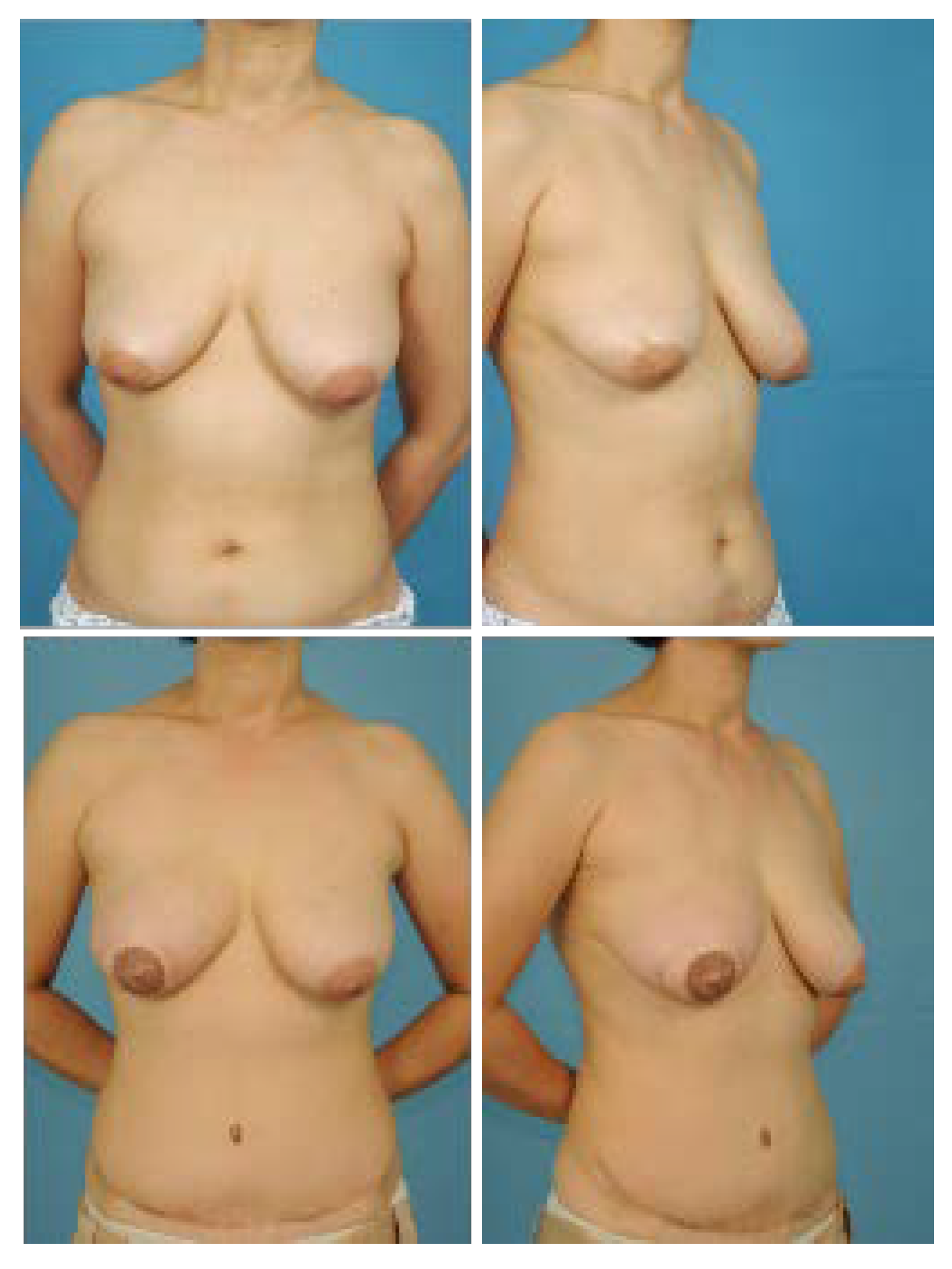 Jcm 11 06647 g010 Jcm 11 06647 g010