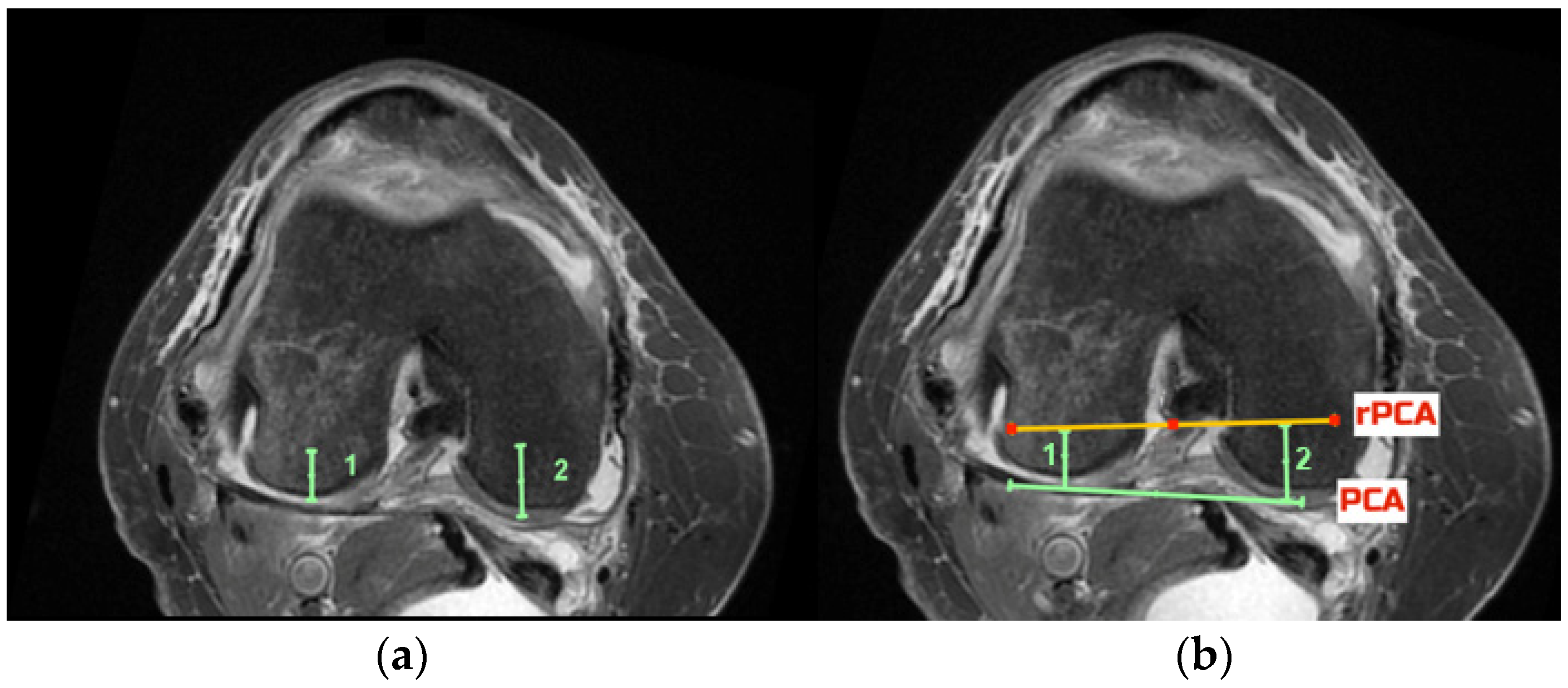 Jcm 11 06680 g002 Jcm 11 06680 g002