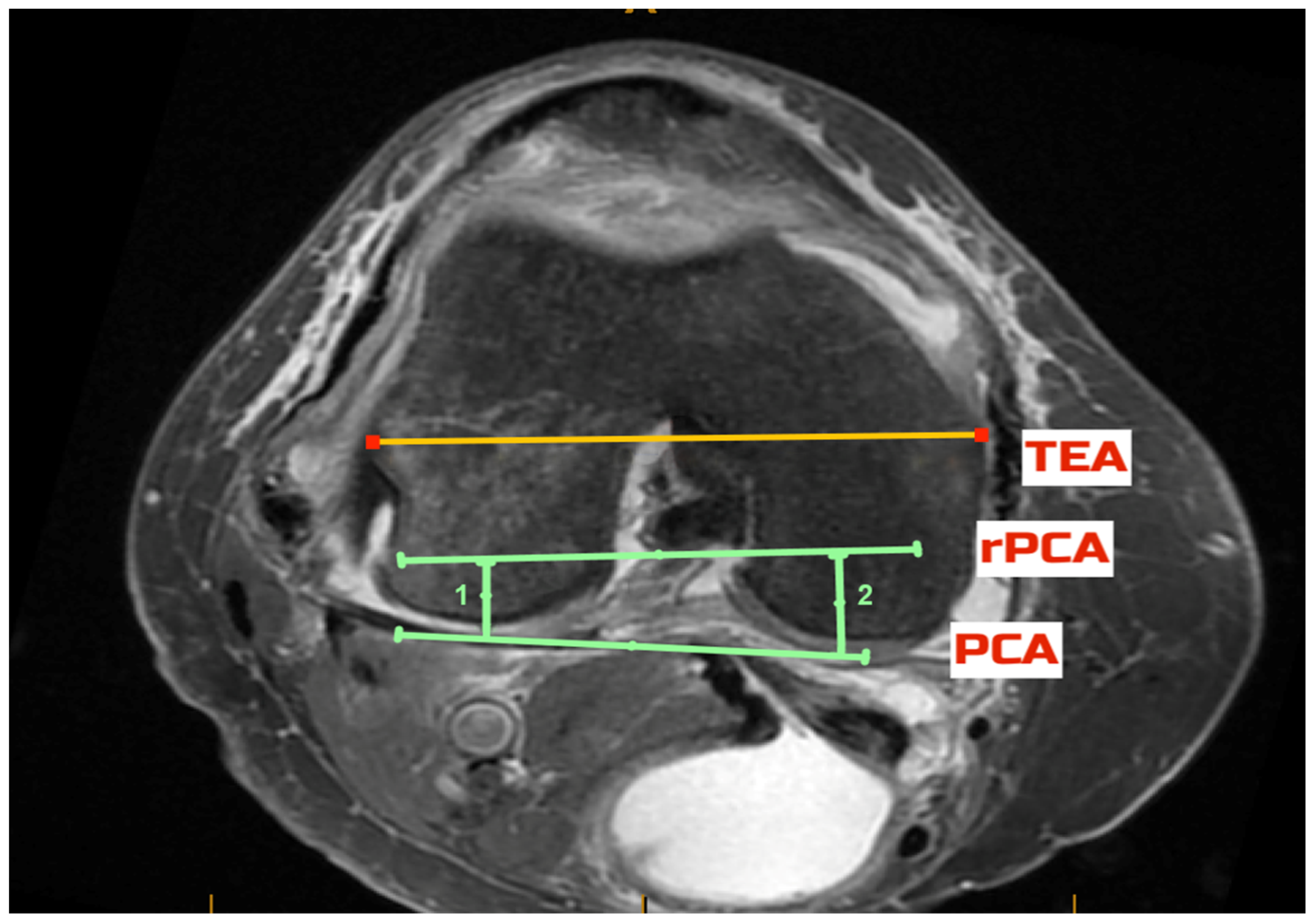 Jcm 11 06680 g003 Jcm 11 06680 g003