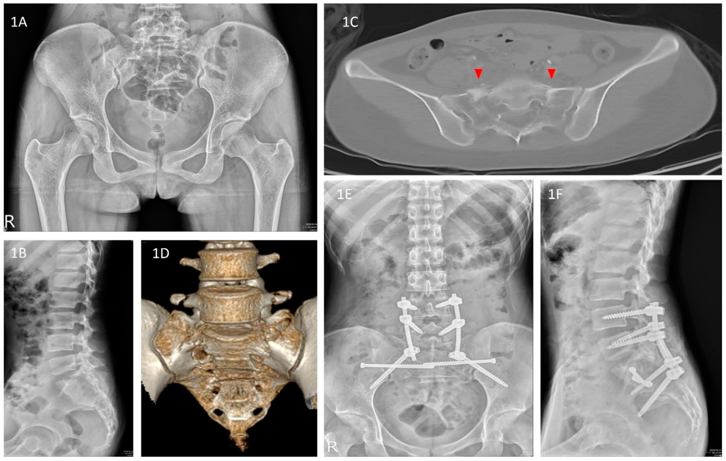Jcm 11 06715 g001 Jcm 11 06715 g001