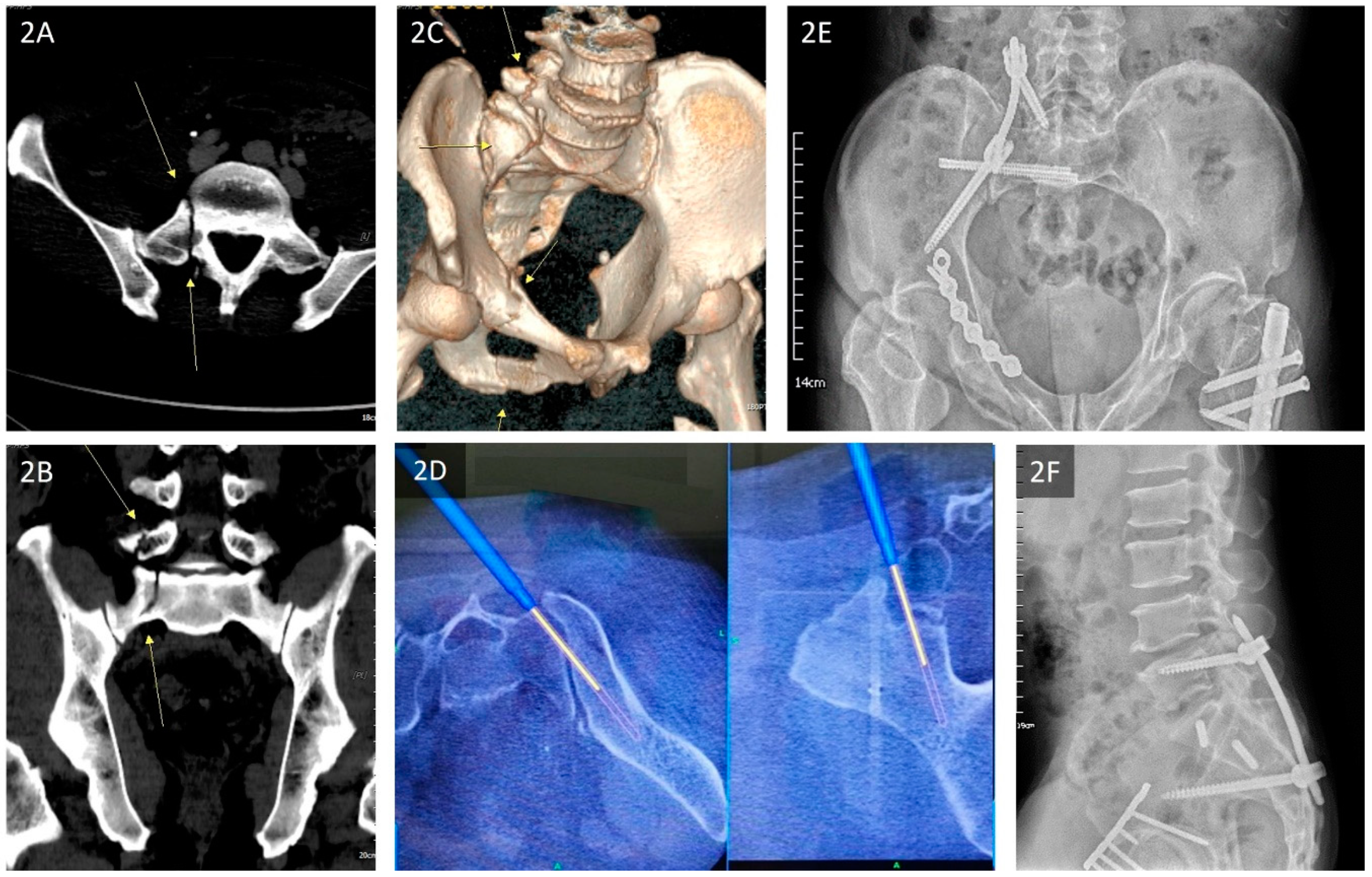 Jcm 11 06715 g002 Jcm 11 06715 g002