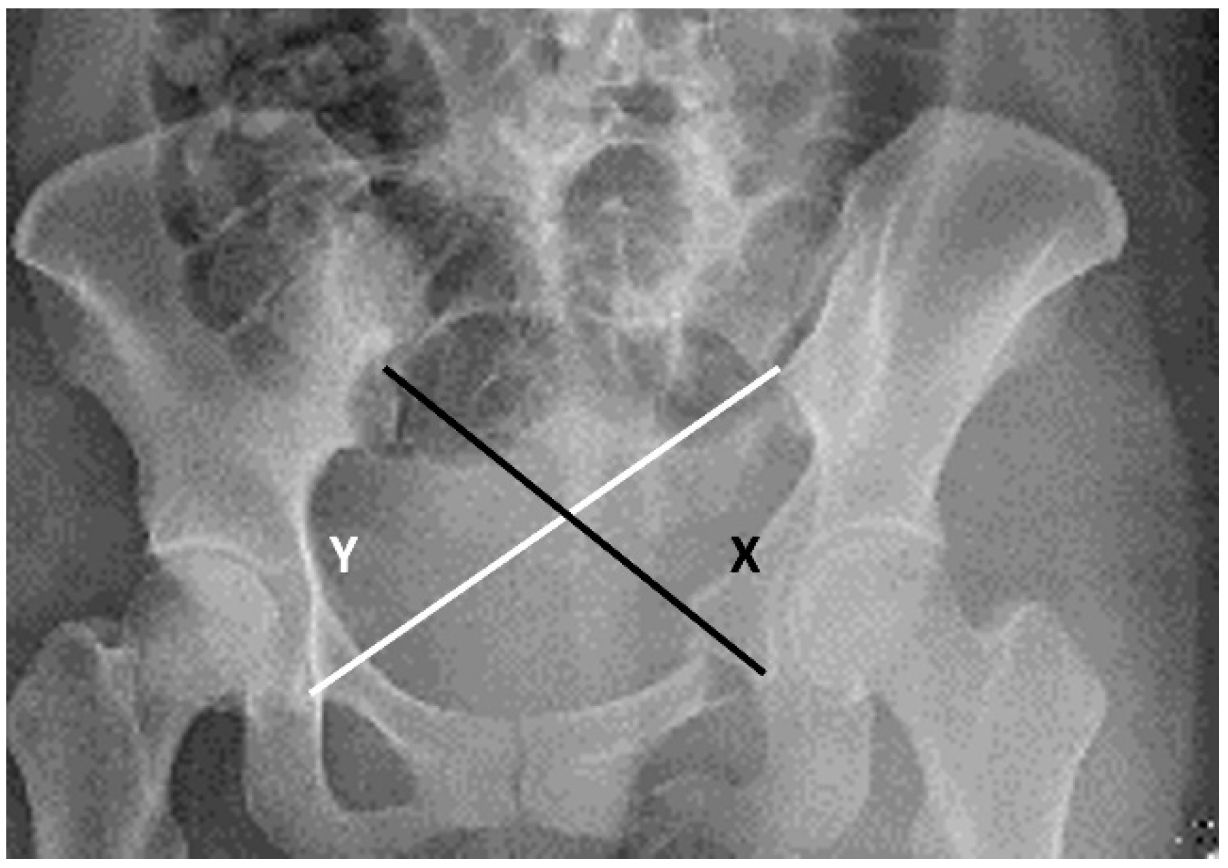 Jcm 11 06715 g004 Jcm 11 06715 g004