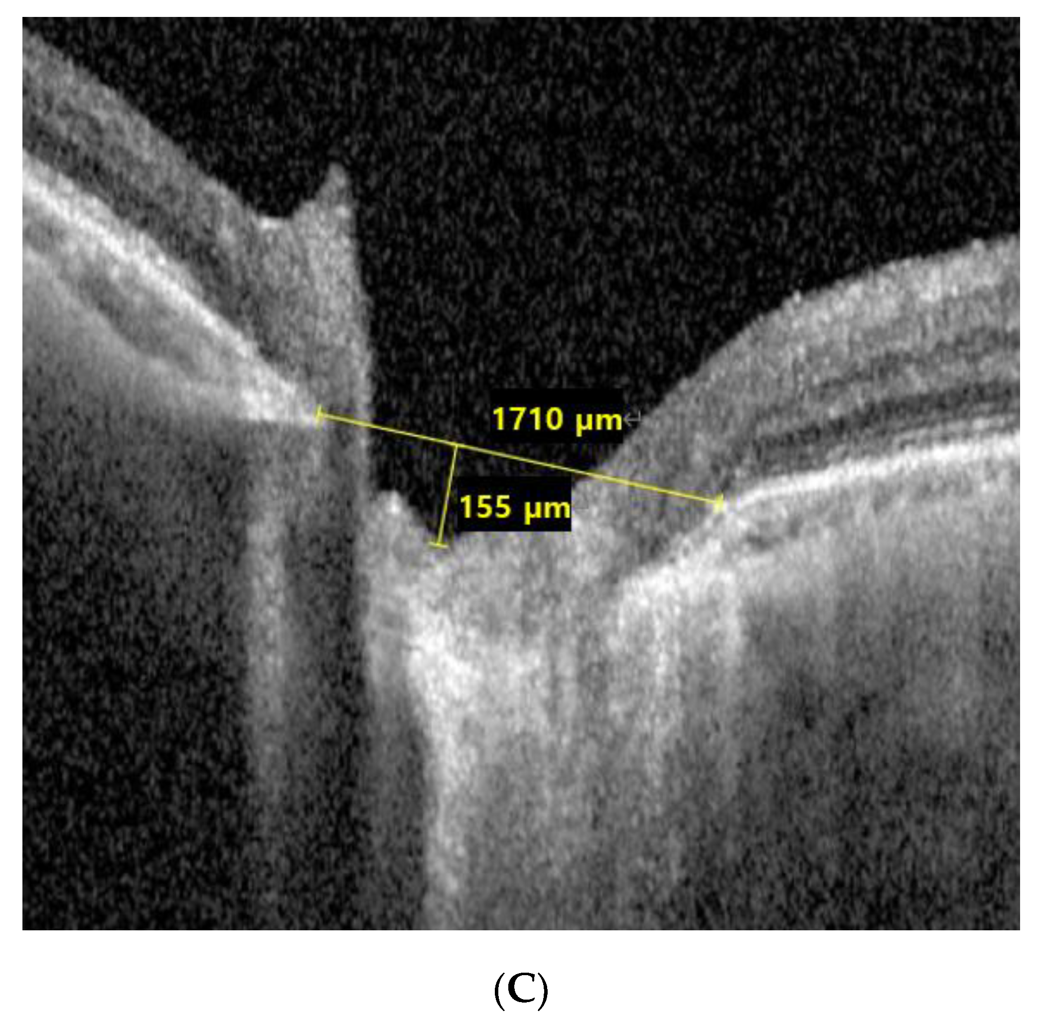 Jcm 11 06728 g002b Jcm 11 06728 g002b