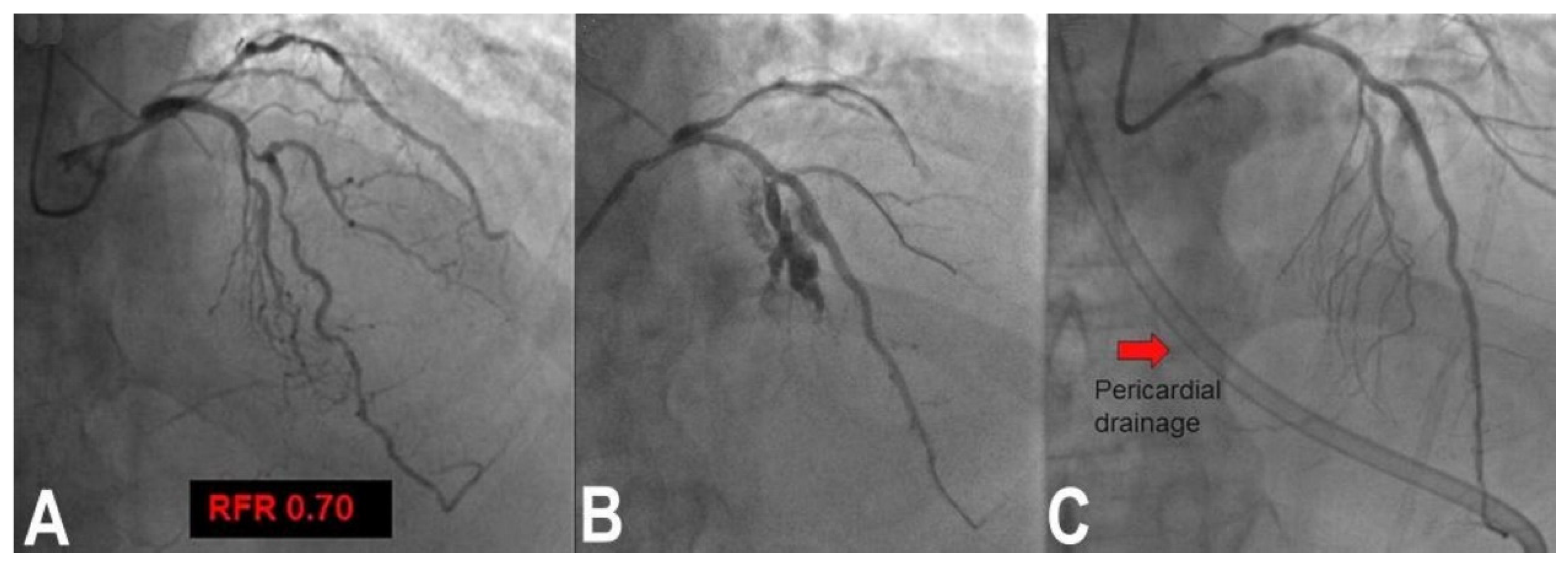 Jcm 11 06801 g002 Jcm 11 06801 g002