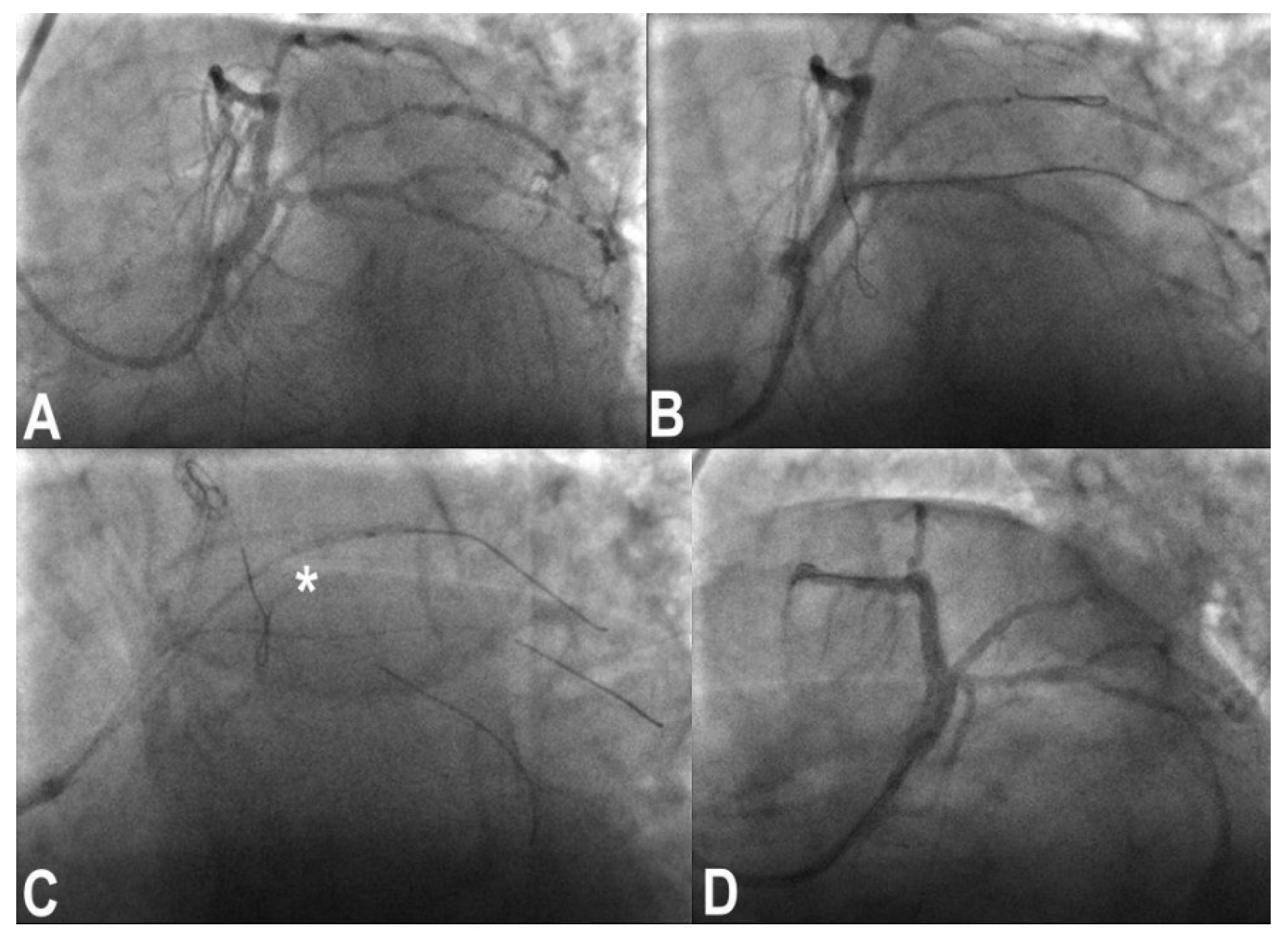 Jcm 11 06801 g004 Jcm 11 06801 g004