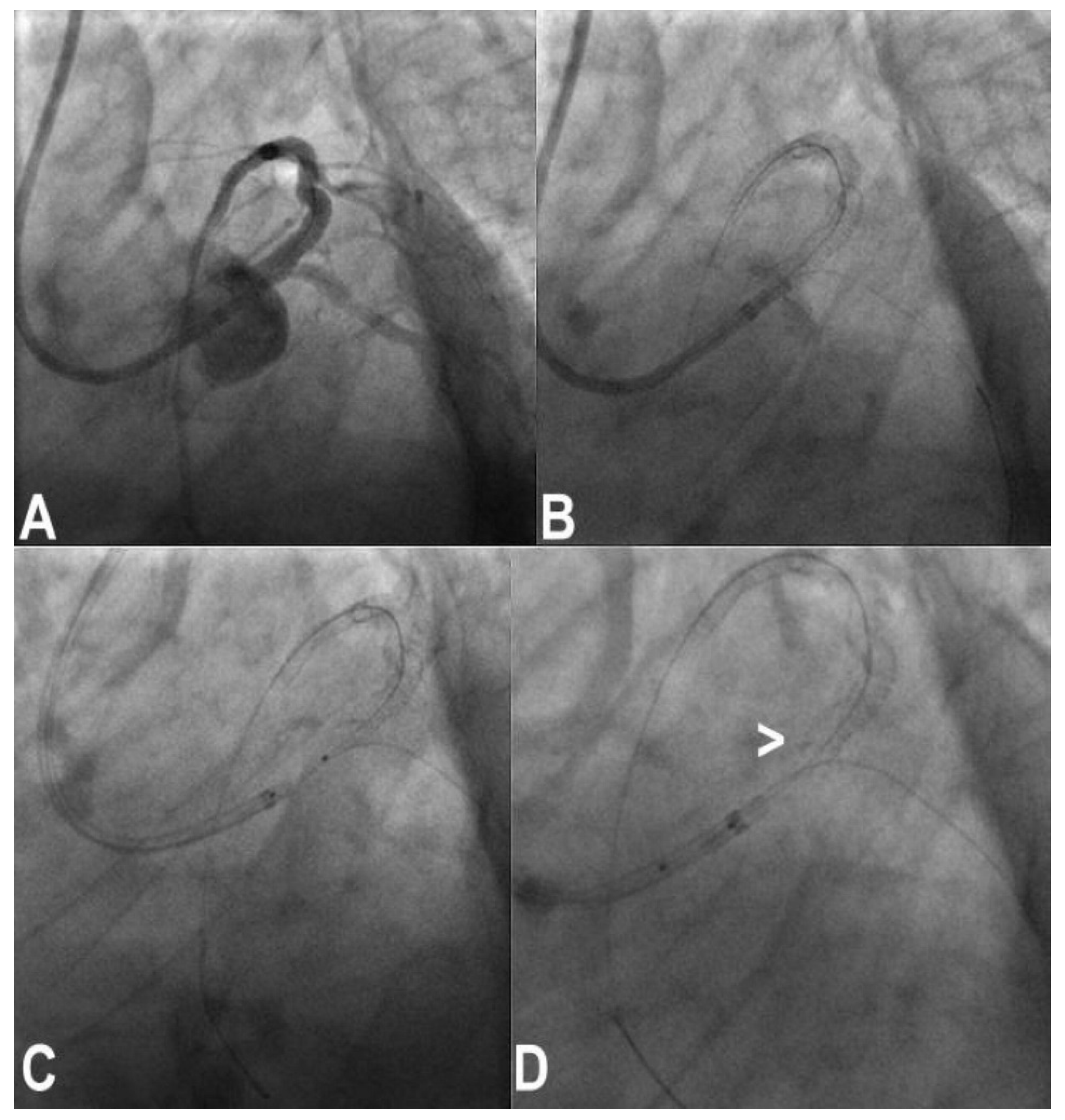 Jcm 11 06801 g006 Jcm 11 06801 g006