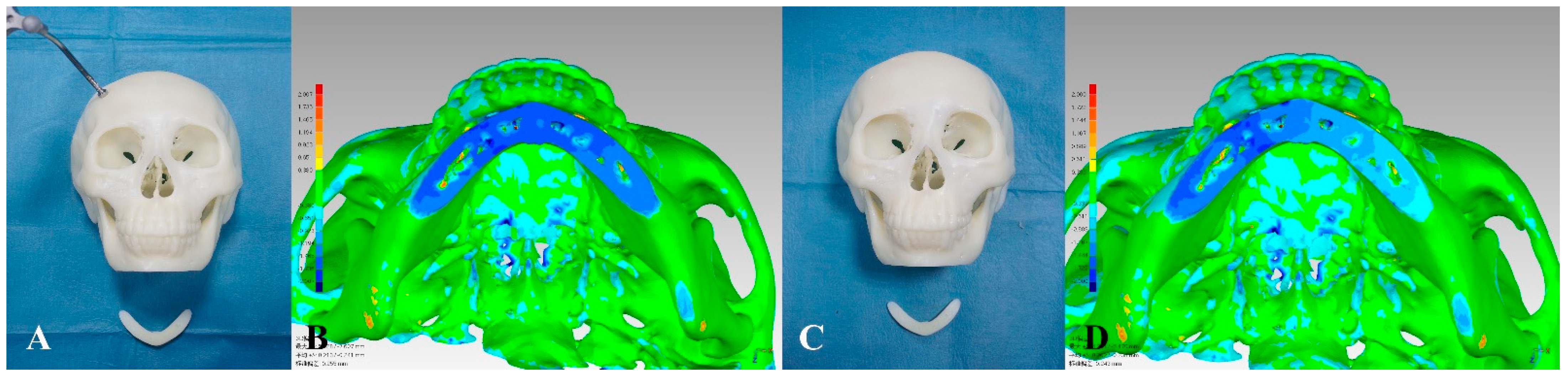 Jcm 11 06807 g006 Jcm 11 06807 g006