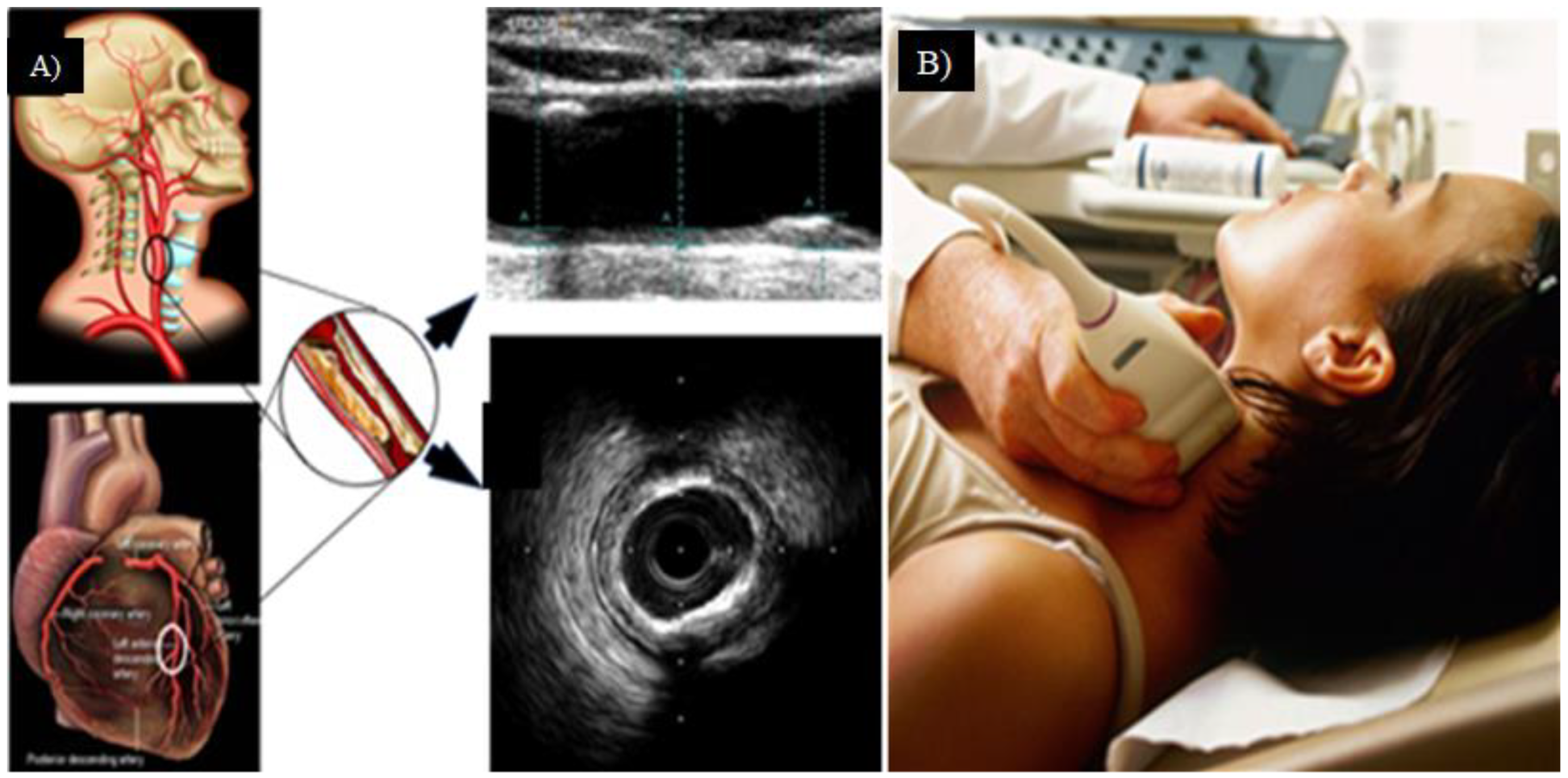 Jcm 11 06844 g009 Jcm 11 06844 g009