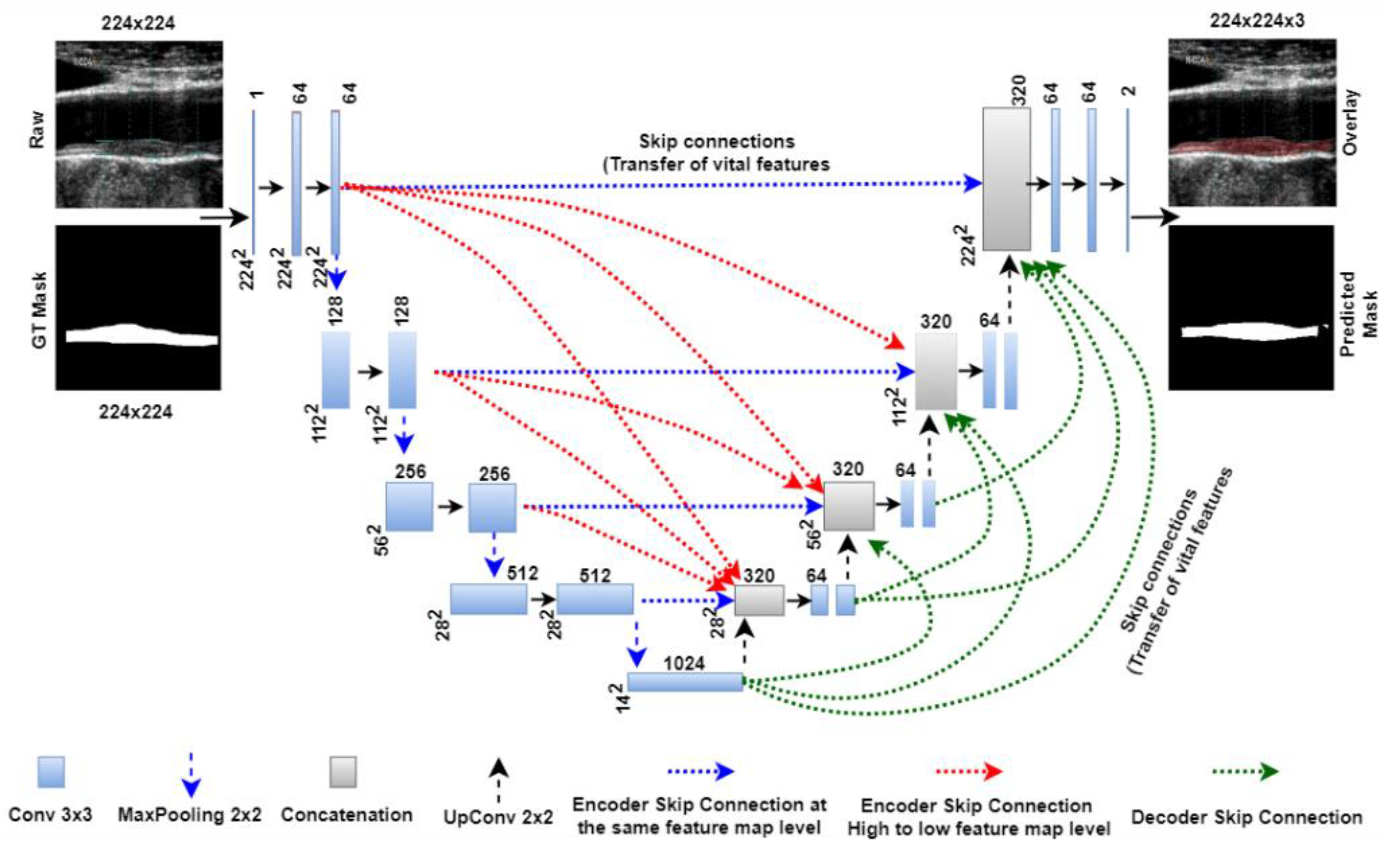 Jcm 11 06844 g0a2 Jcm 11 06844 g0a2