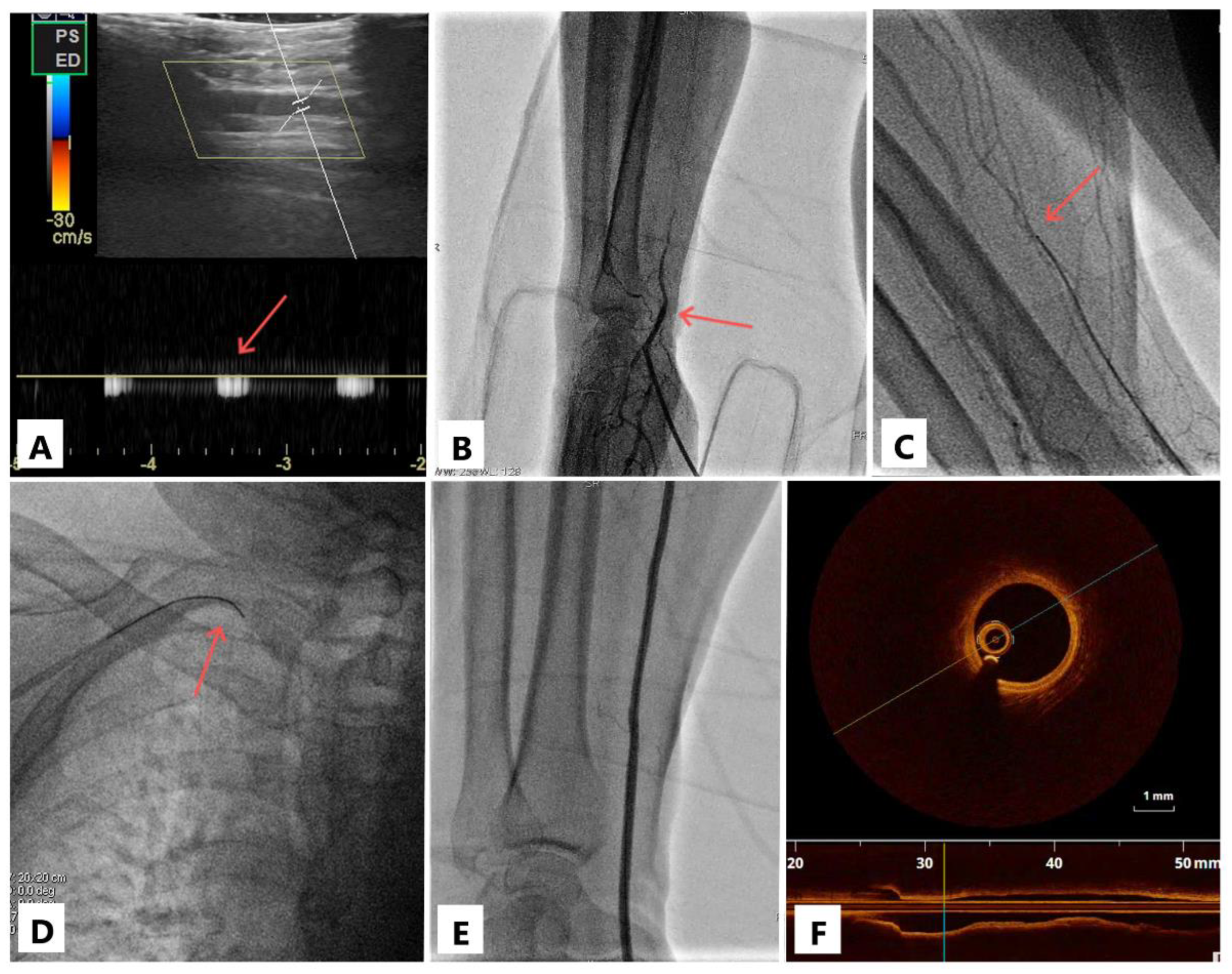 Jcm 11 06916 g001 Jcm 11 06916 g001