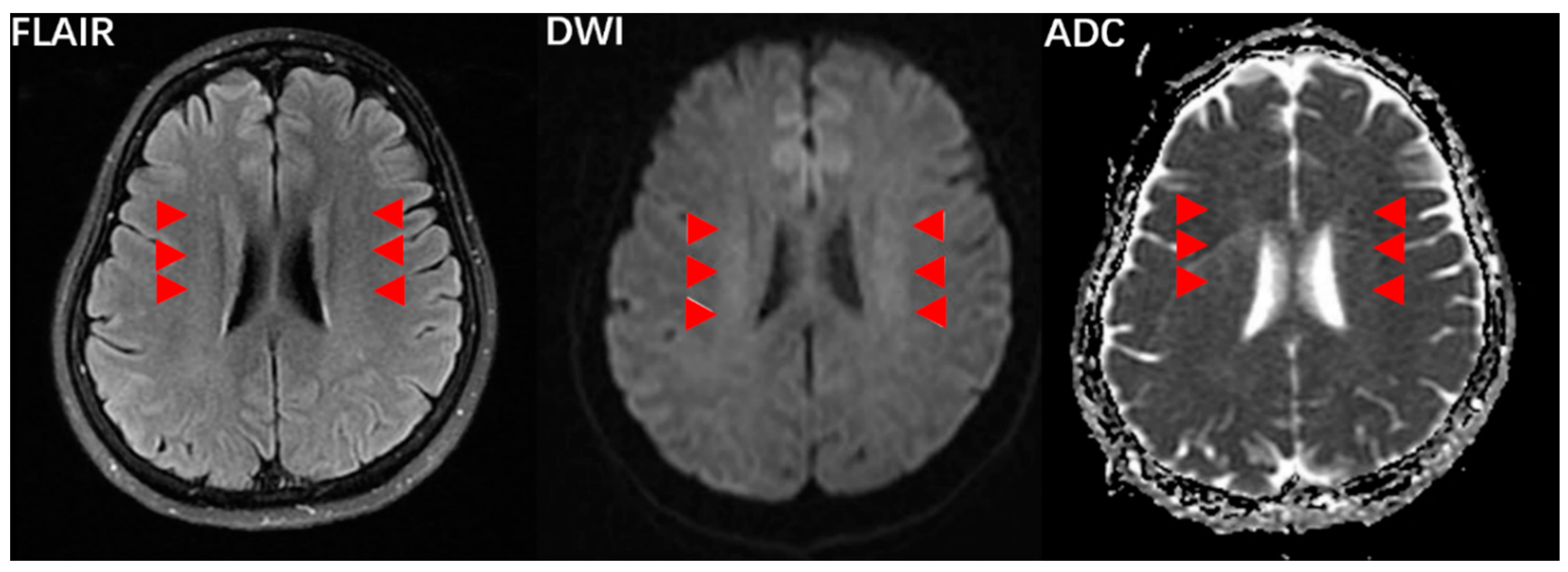 Jcm 11 06927 g002 Jcm 11 06927 g002
