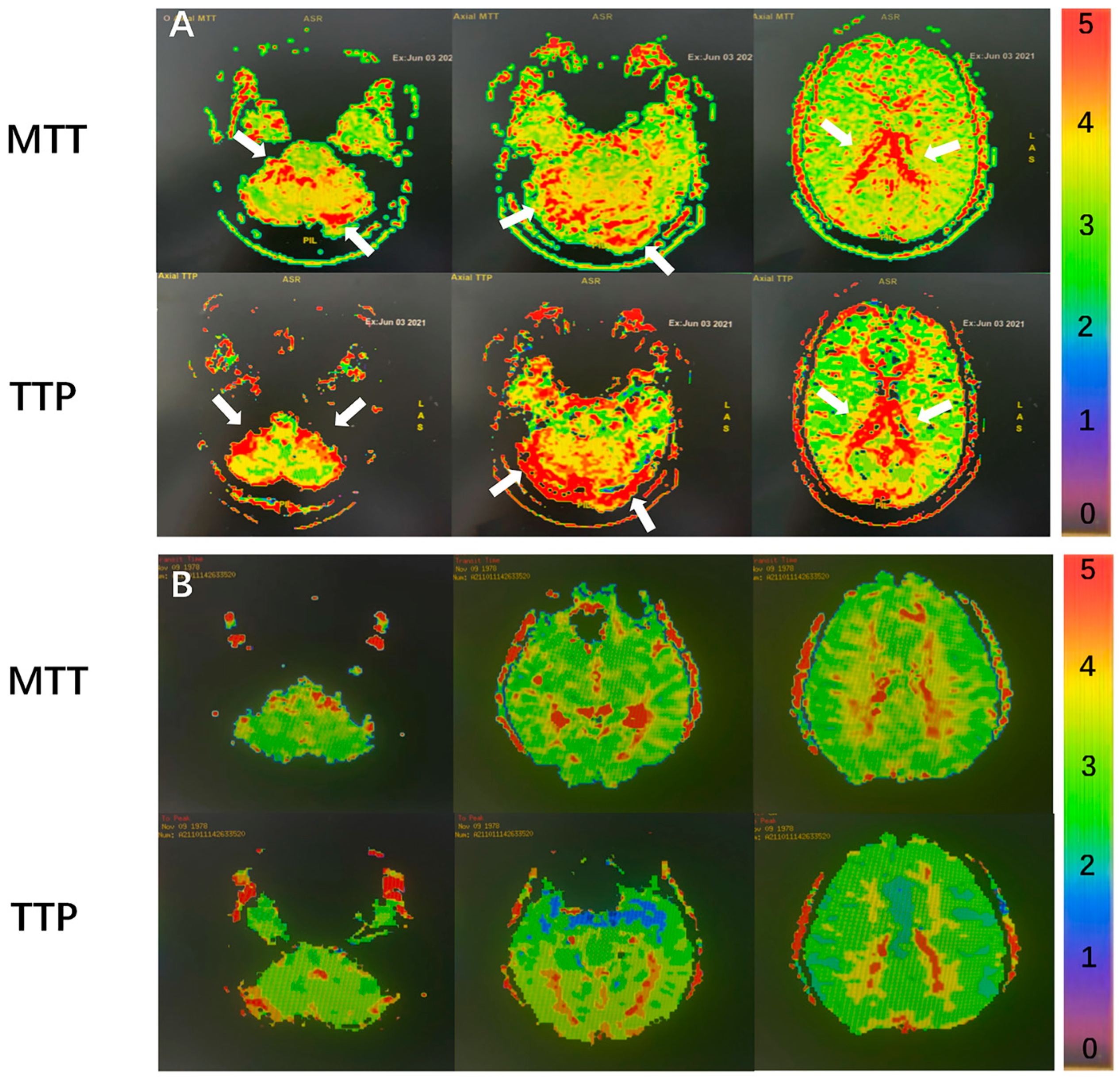 Jcm 11 06927 g003 Jcm 11 06927 g003