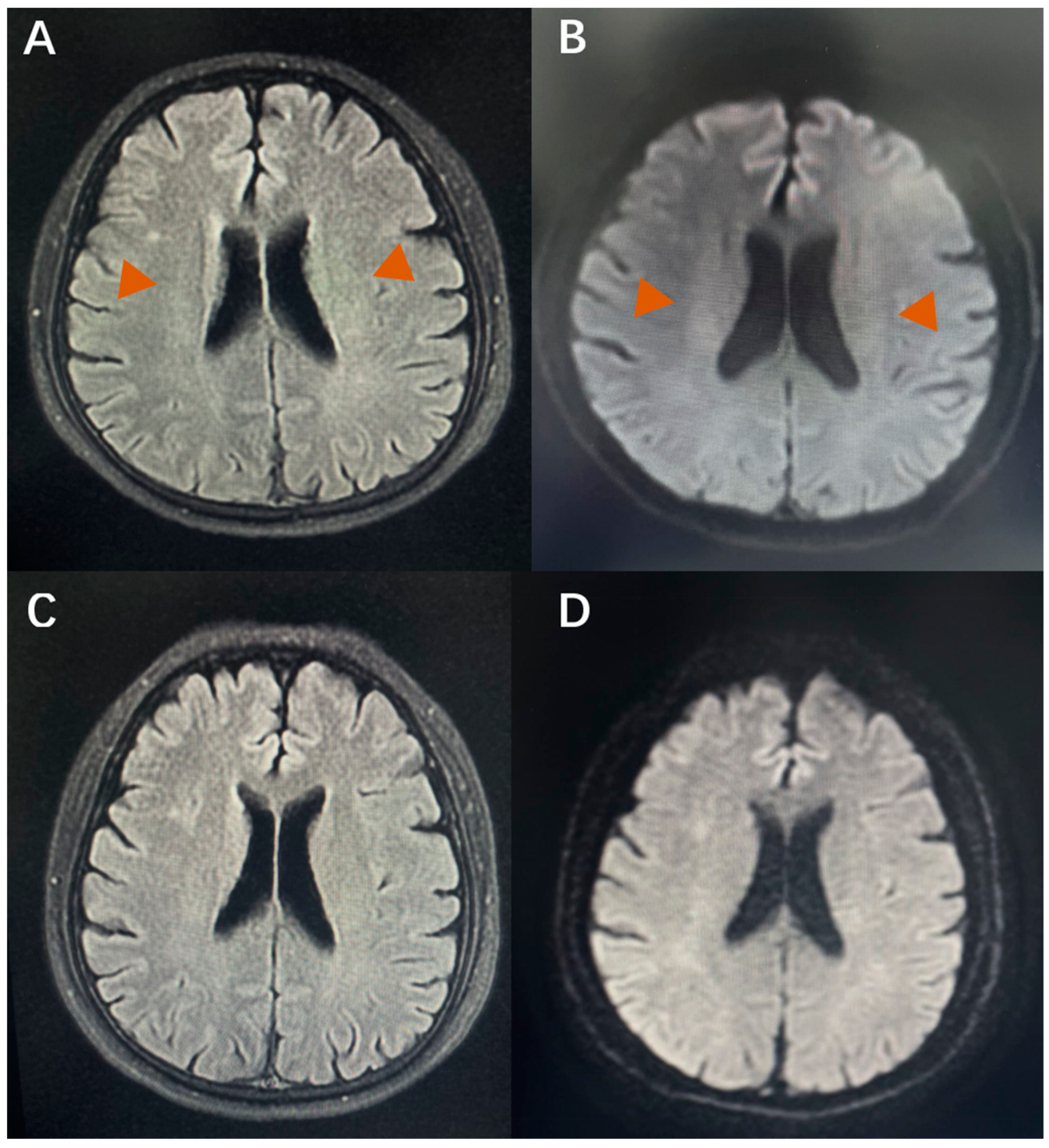 Jcm 11 06927 g004 Jcm 11 06927 g004