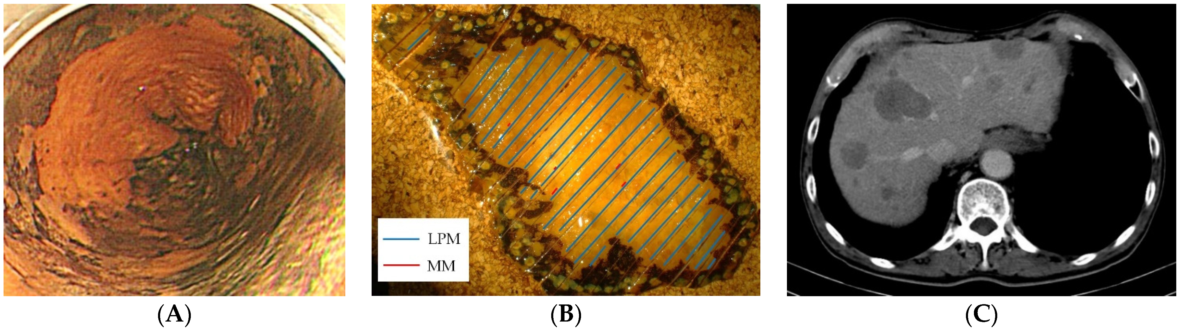 Jcm 11 06969 g002 Jcm 11 06969 g002