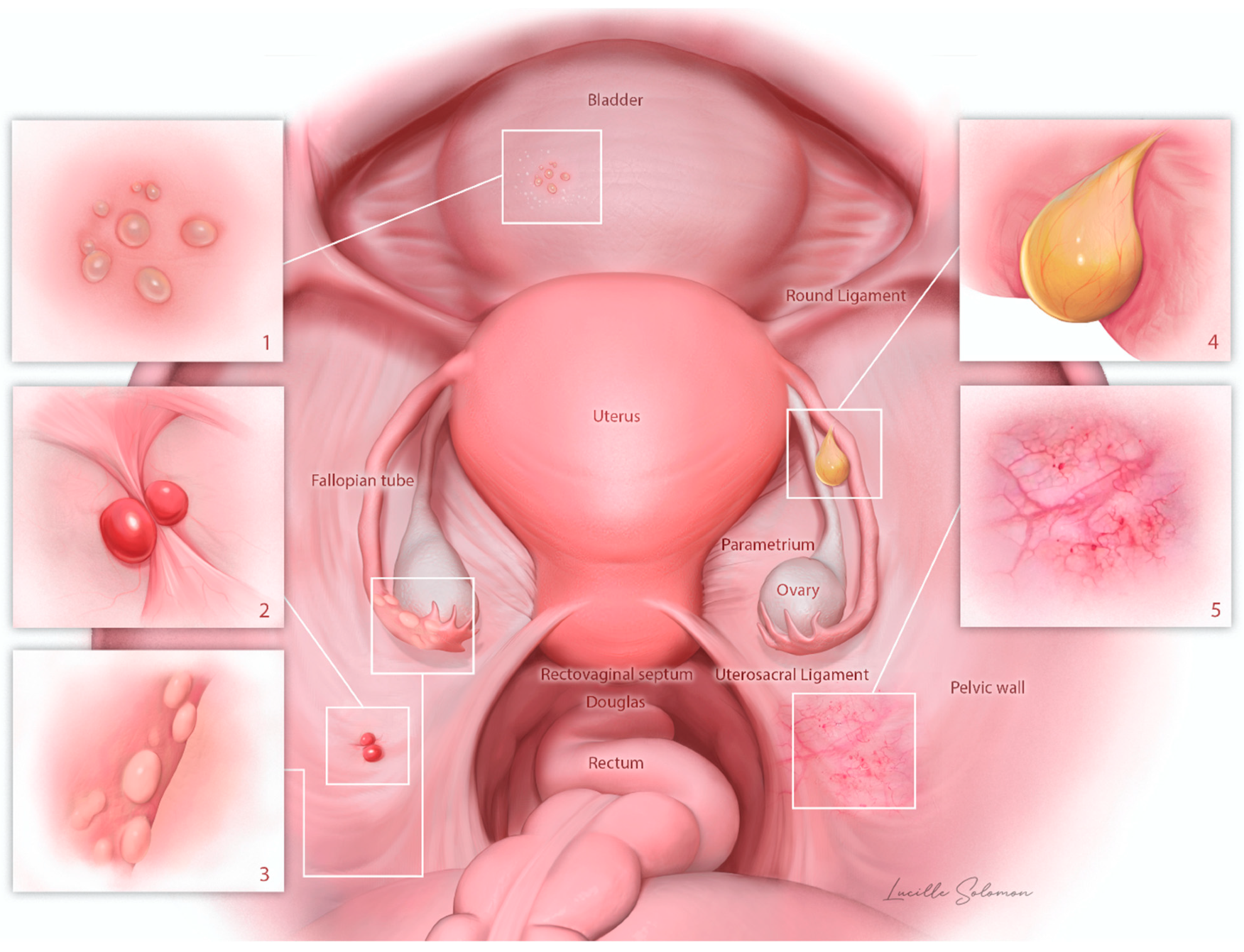 Jcm 11 07006 g002 Jcm 11 07006 g002