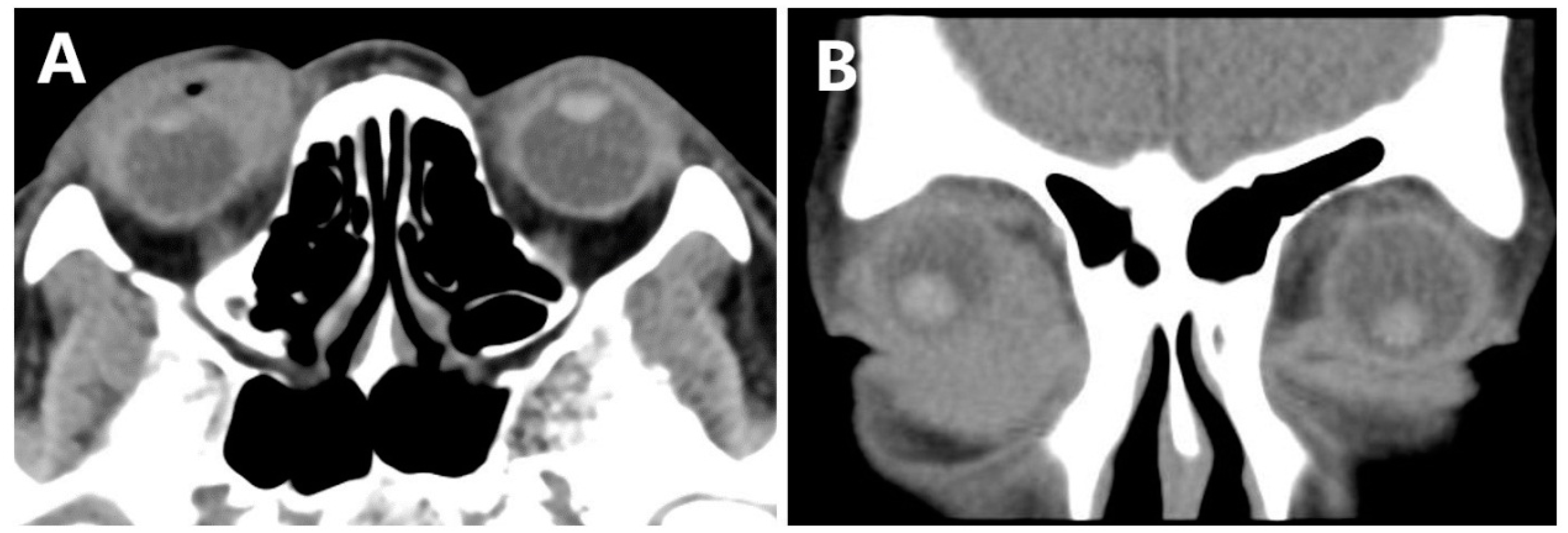 Jcm 11 07010 g002 Jcm 11 07010 g002