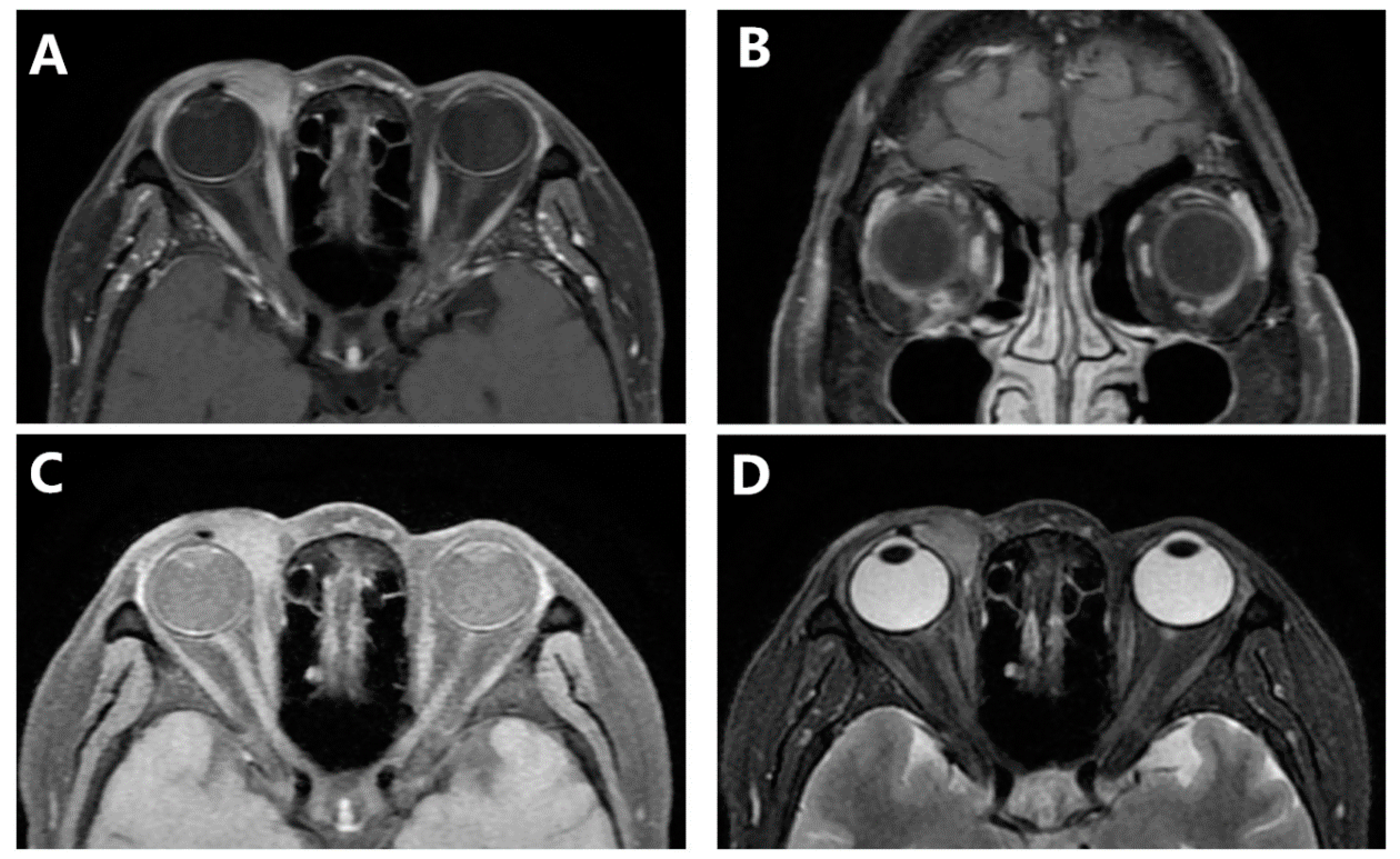 Jcm 11 07010 g003 Jcm 11 07010 g003