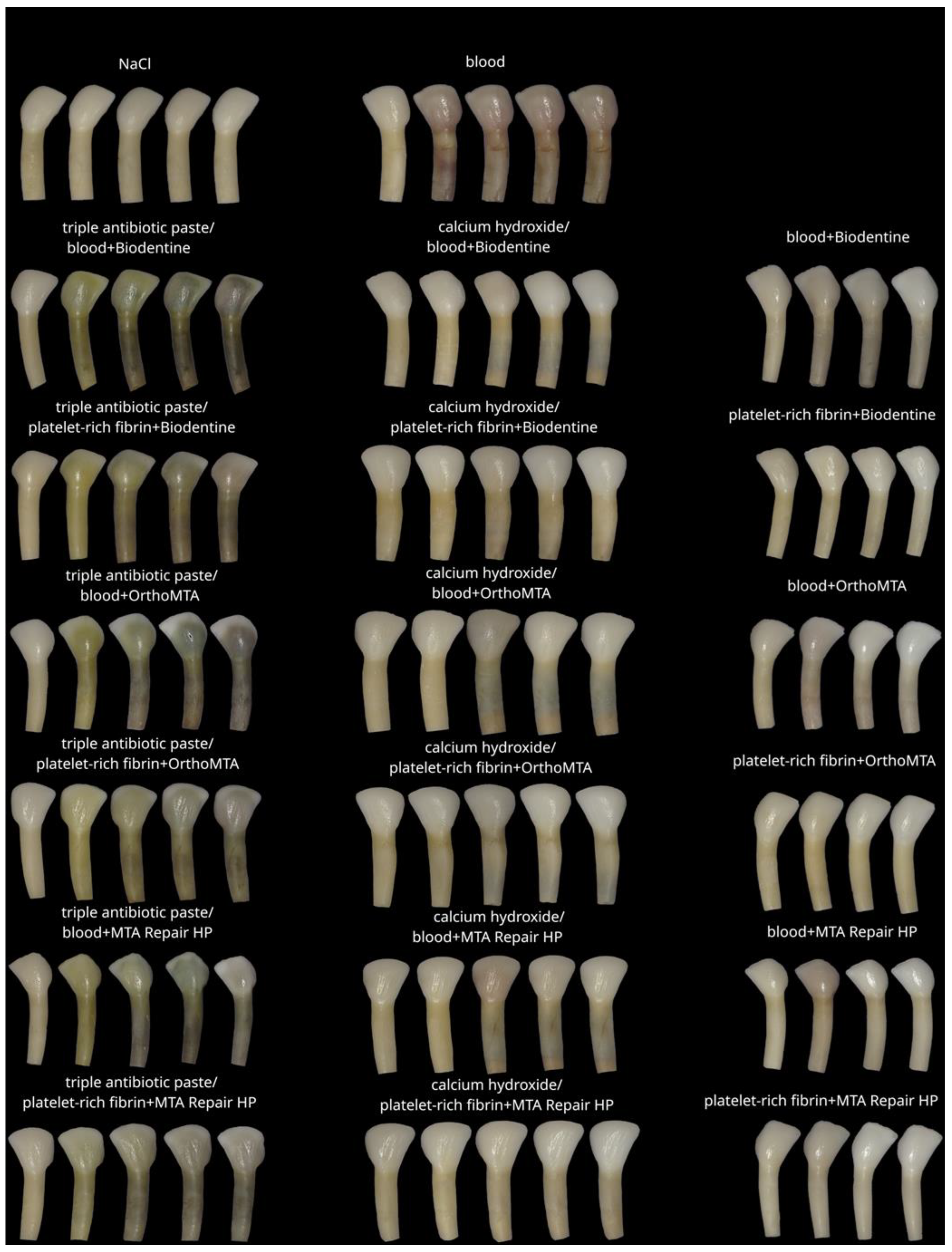 Jcm 11 07016 g009 Jcm 11 07016 g009