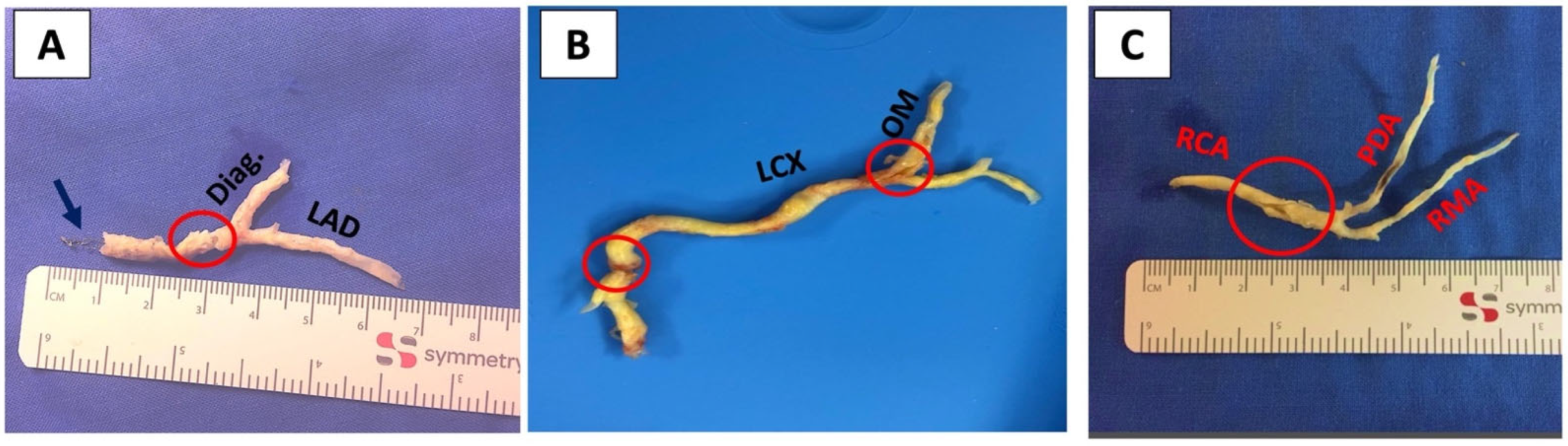Jcm 11 07026 g001 Jcm 11 07026 g001