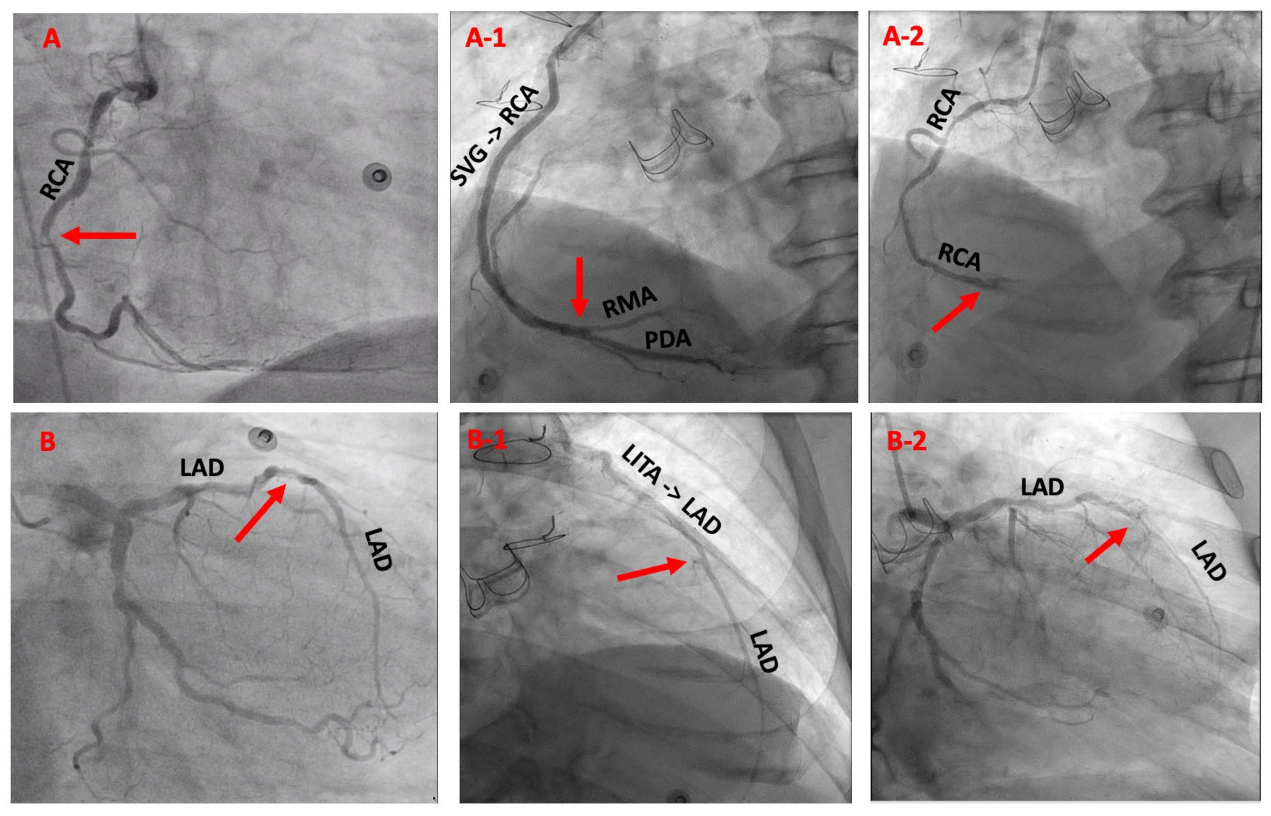 Jcm 11 07026 g002 Jcm 11 07026 g002