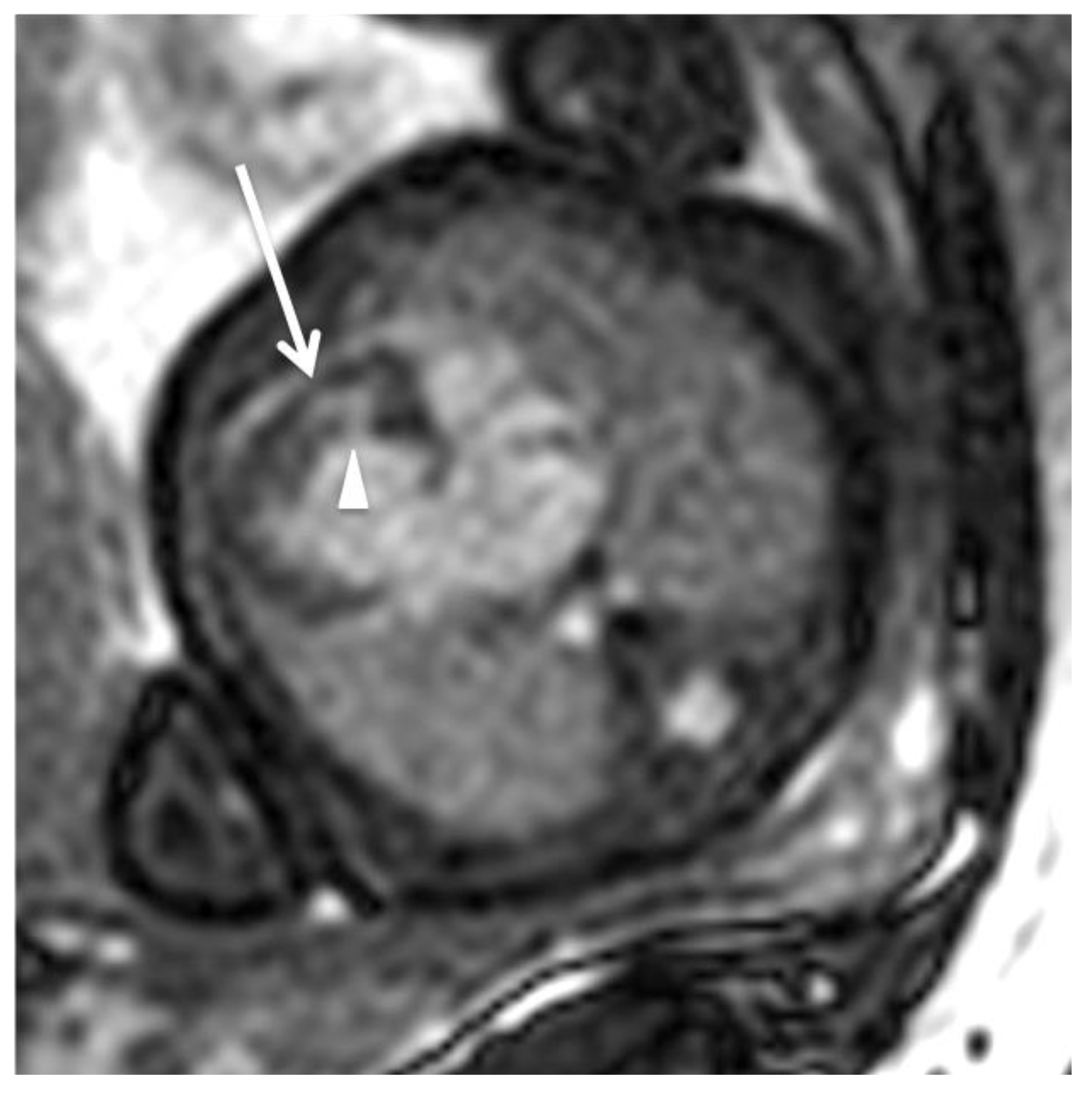 Jcm 11 07027 g002 Jcm 11 07027 g002