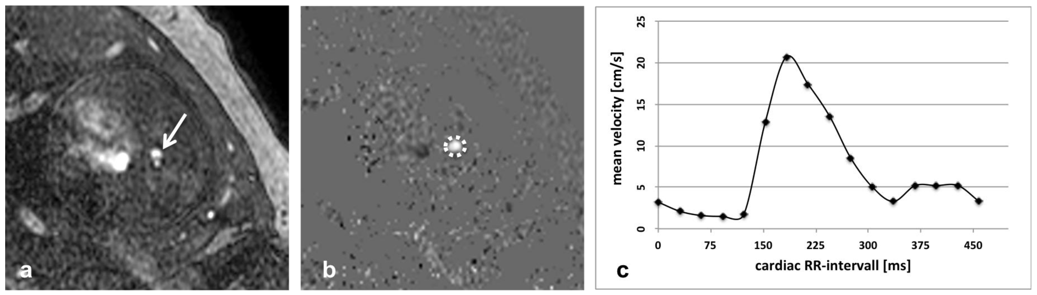 Jcm 11 07027 g003 Jcm 11 07027 g003