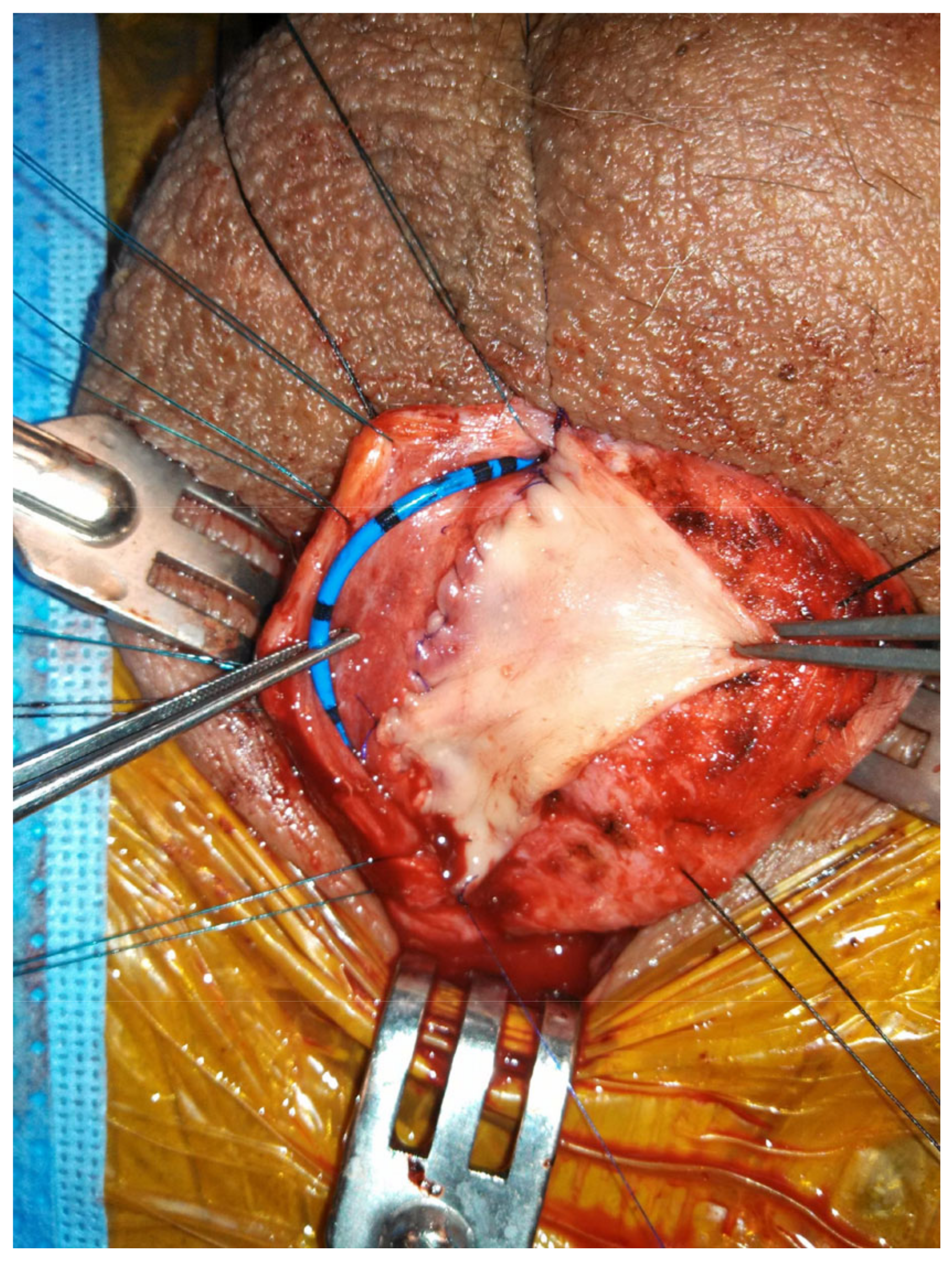 Jcm 11 07033 g002 550