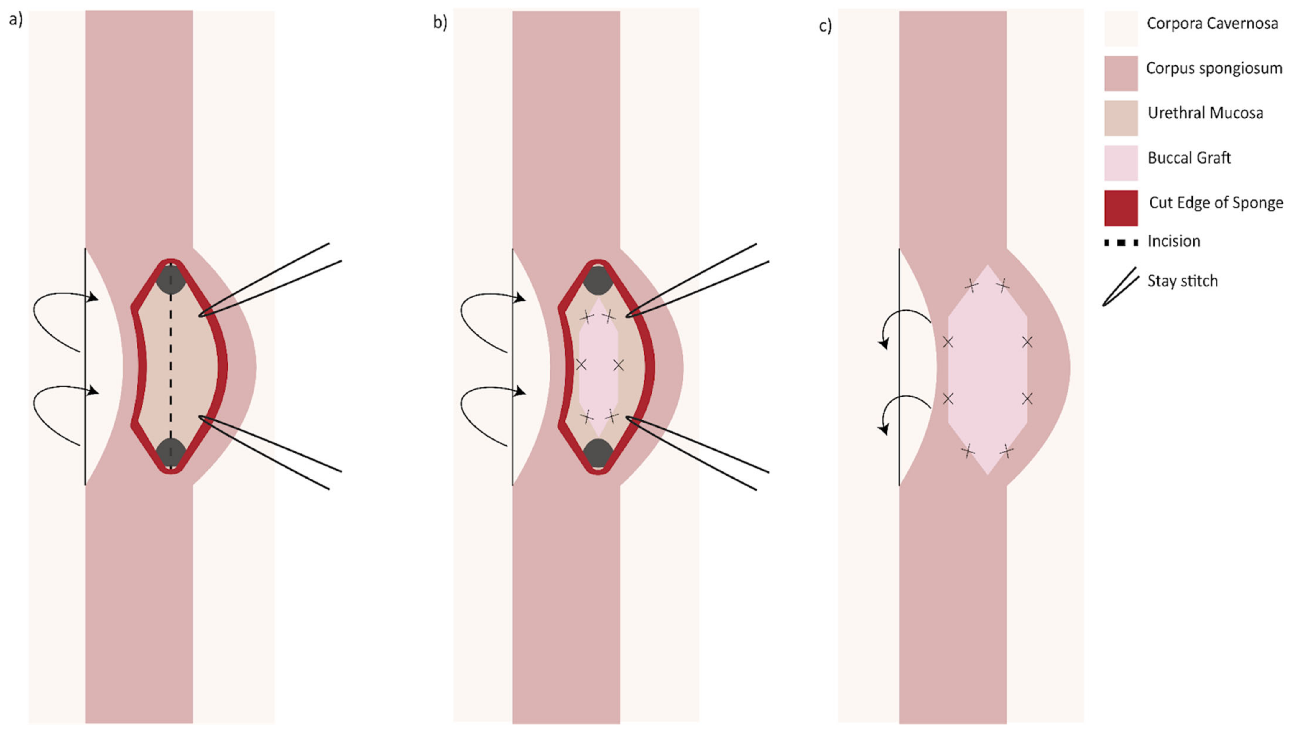 Jcm 11 07033 g004 550