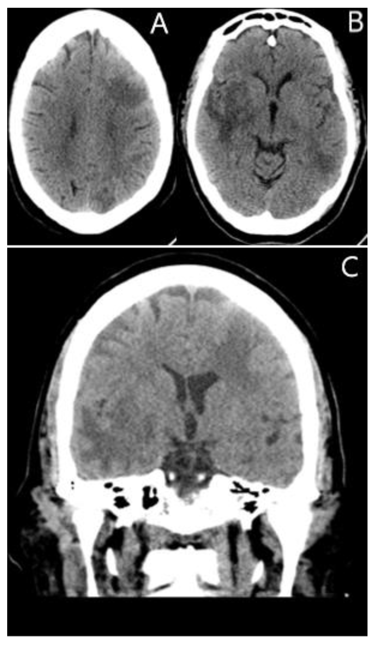 Jcm 11 07058 g001 Jcm 11 07058 g001