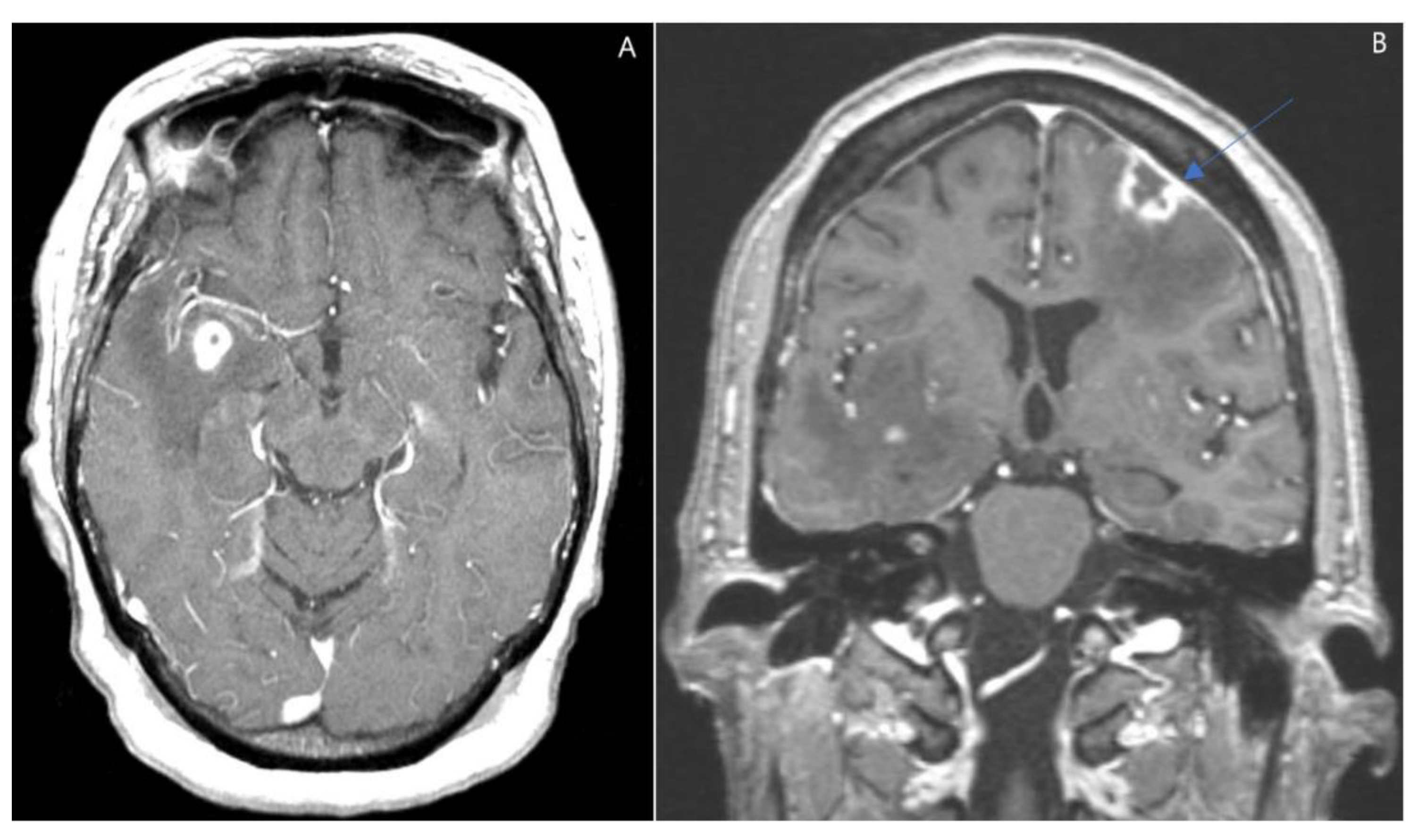 Jcm 11 07058 g004 Jcm 11 07058 g004