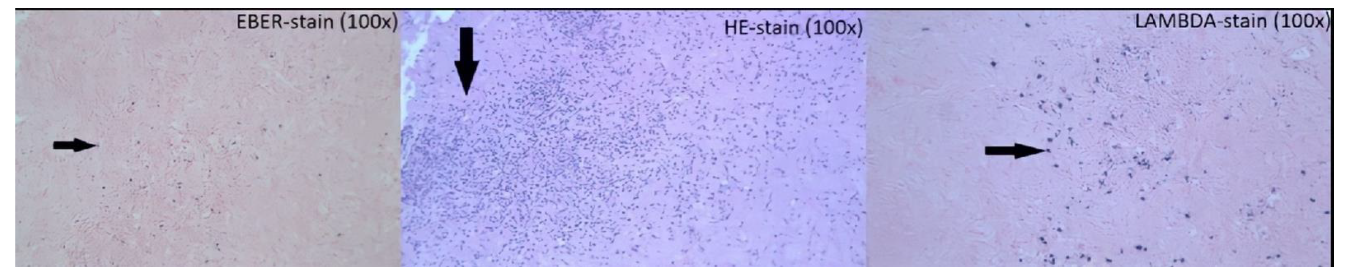 Jcm 11 07058 g005 Jcm 11 07058 g005