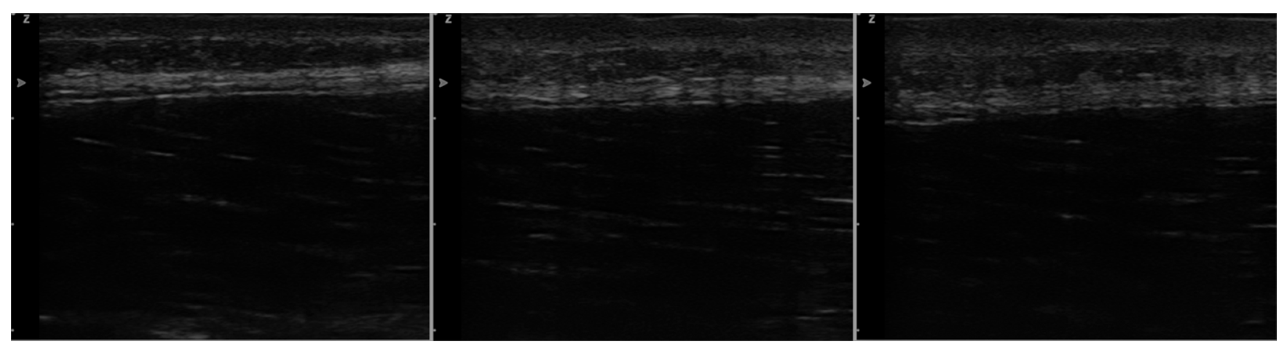 Jcm 11 07110 g006 Jcm 11 07110 g006