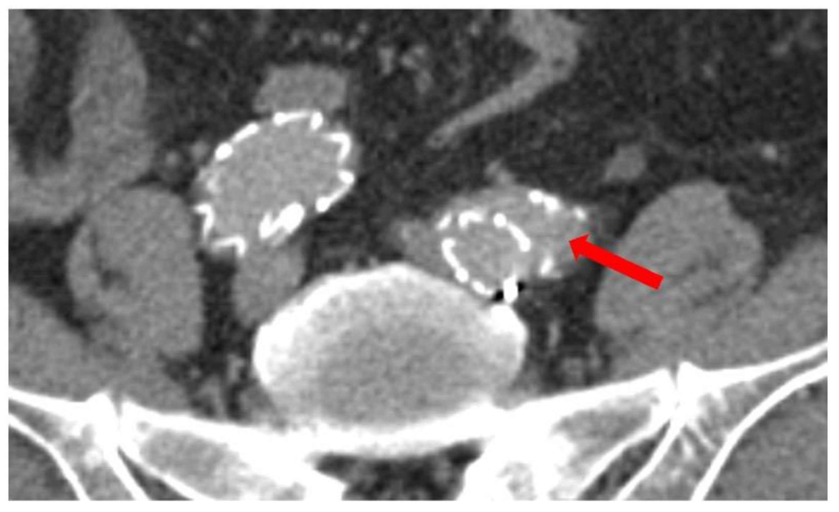 Jcm 11 07113 g002 Jcm 11 07113 g002